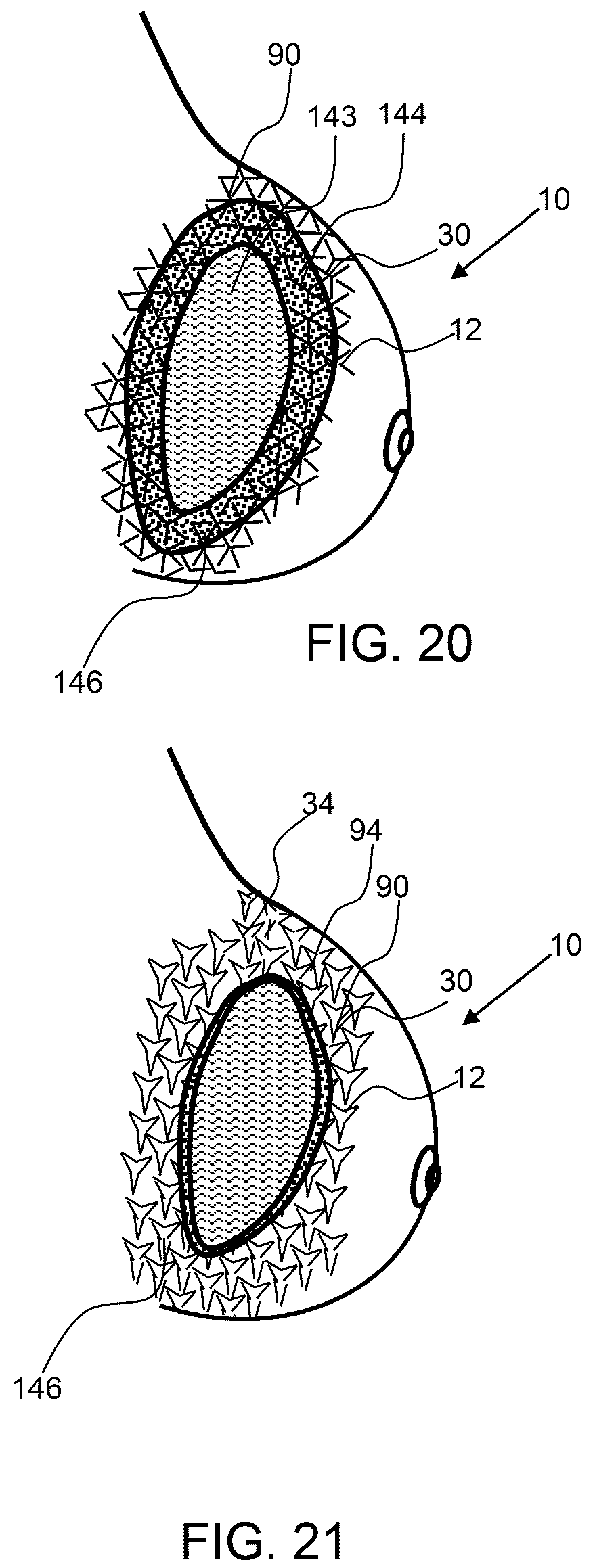 Patent US12588985 Figure 9 – Compliant biological scaffold