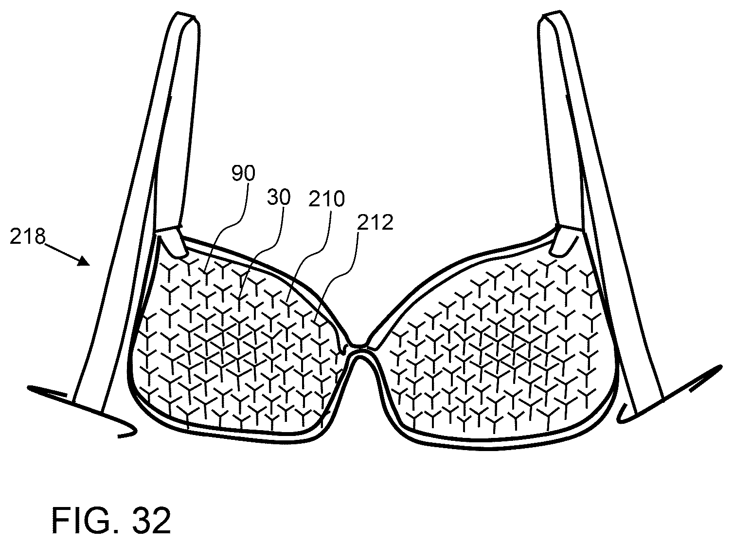 Patent US12588985 Figure 13 – Compliant biological scaffold