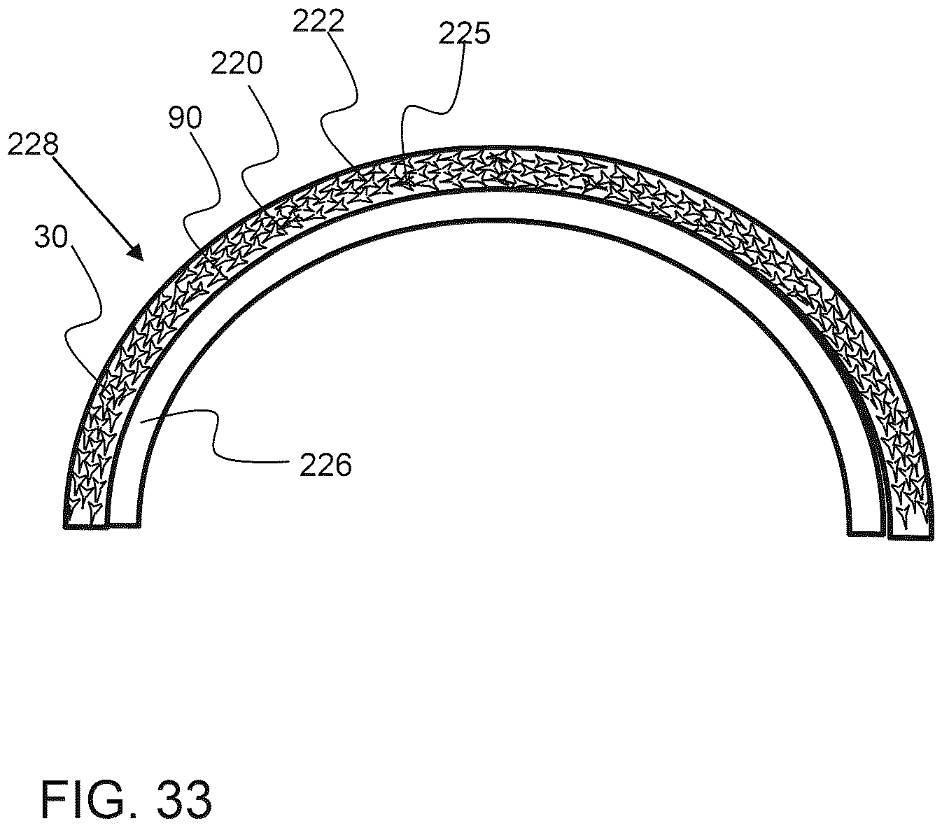 Patent US12588985 Figure 14 – Compliant biological scaffold