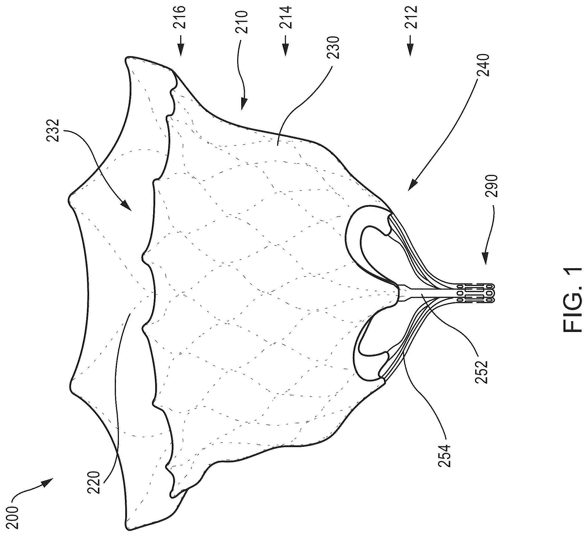 Patent US12588986 Figure 1 – Apparatus and methods for anterior valve leaflet management