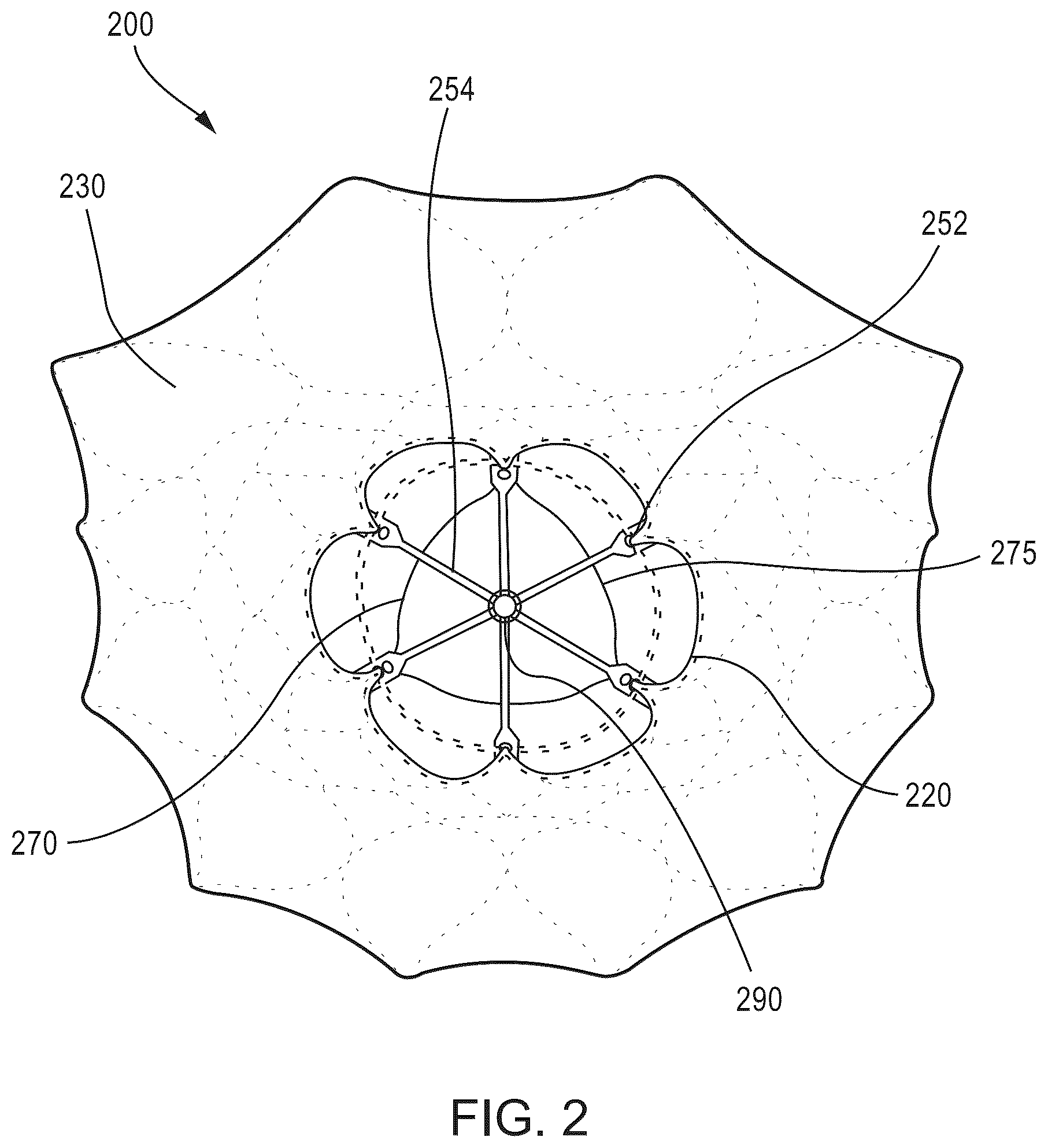 Patent US12588986 Figure 2 – Apparatus and methods for anterior valve leaflet management