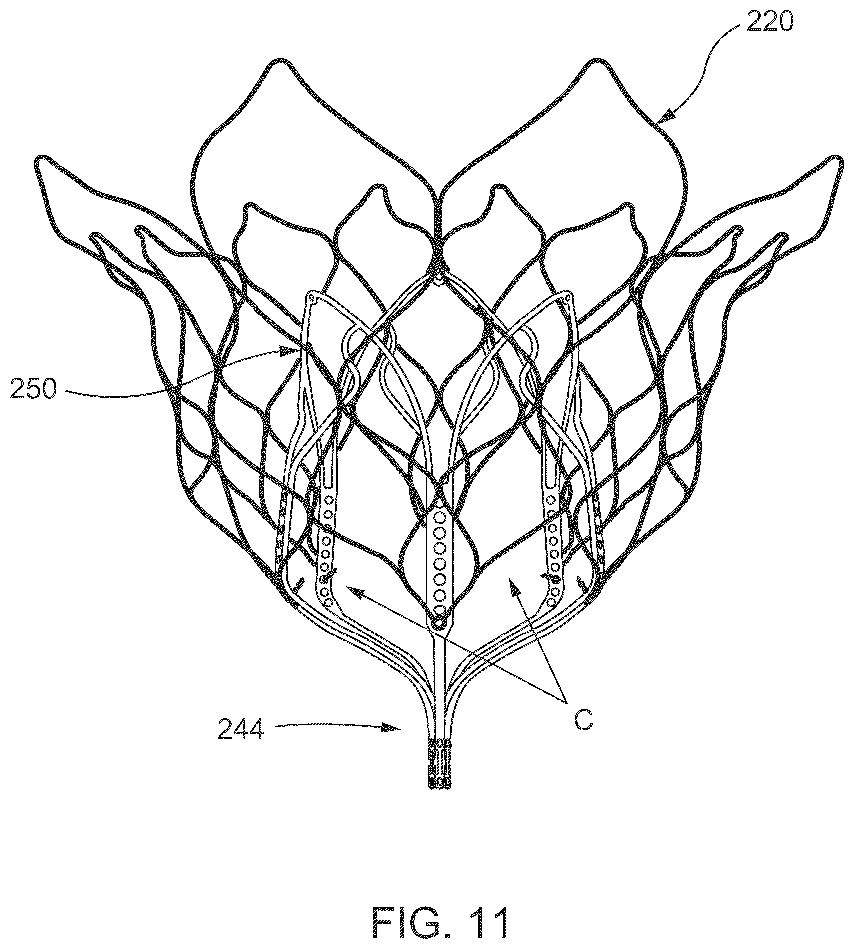 Patent US12588986 Figure 9 – Apparatus and methods for anterior valve leaflet management