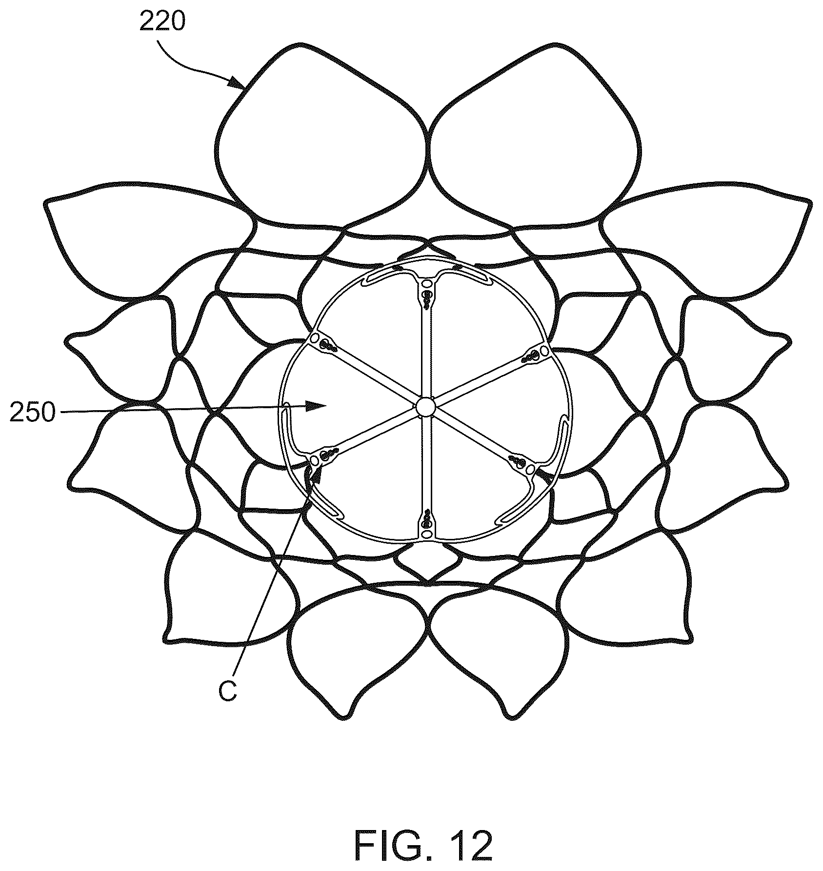 Patent US12588986 Figure 10 – Apparatus and methods for anterior valve leaflet management