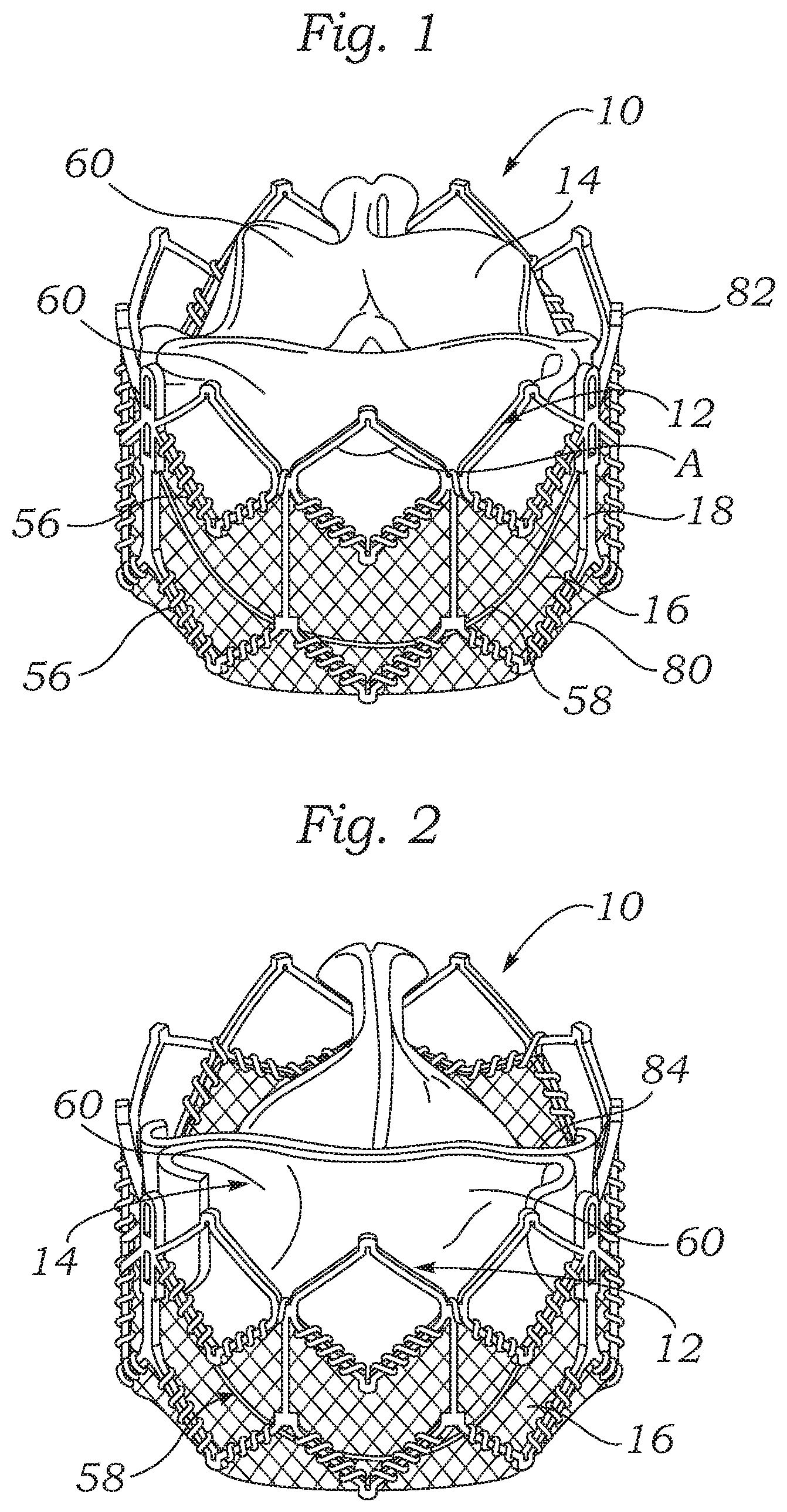 Patent US12588987 Figure 1 – Low profile transcatheter heart valve