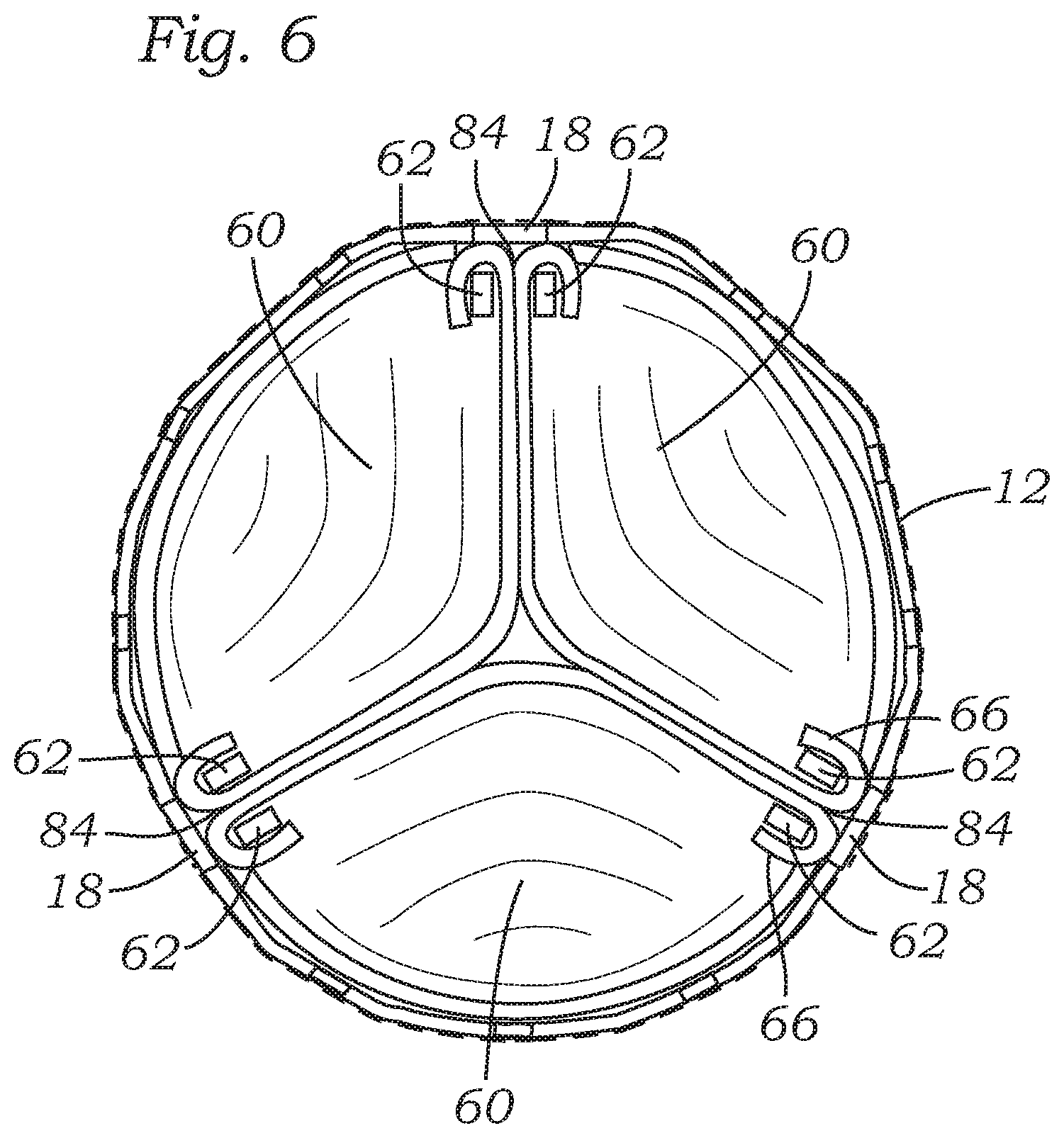 Patent US12588987 Figure 3 – Low profile transcatheter heart valve