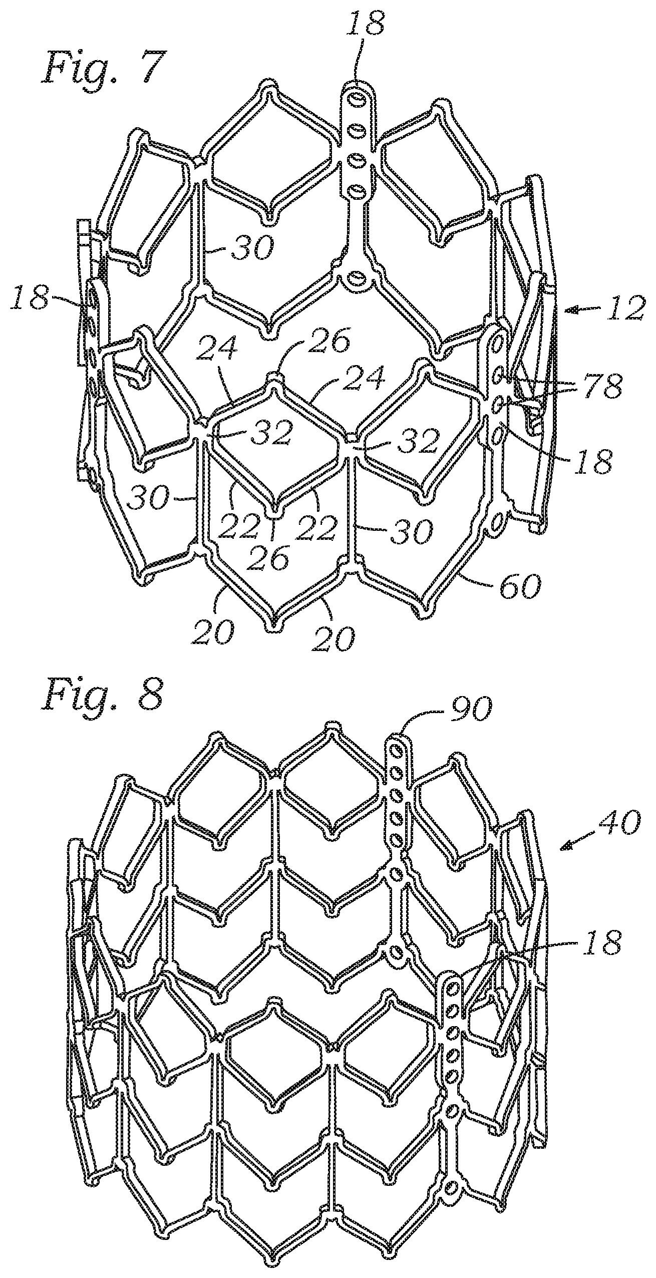 Patent US12588987 Figure 5 – Low profile transcatheter heart valve