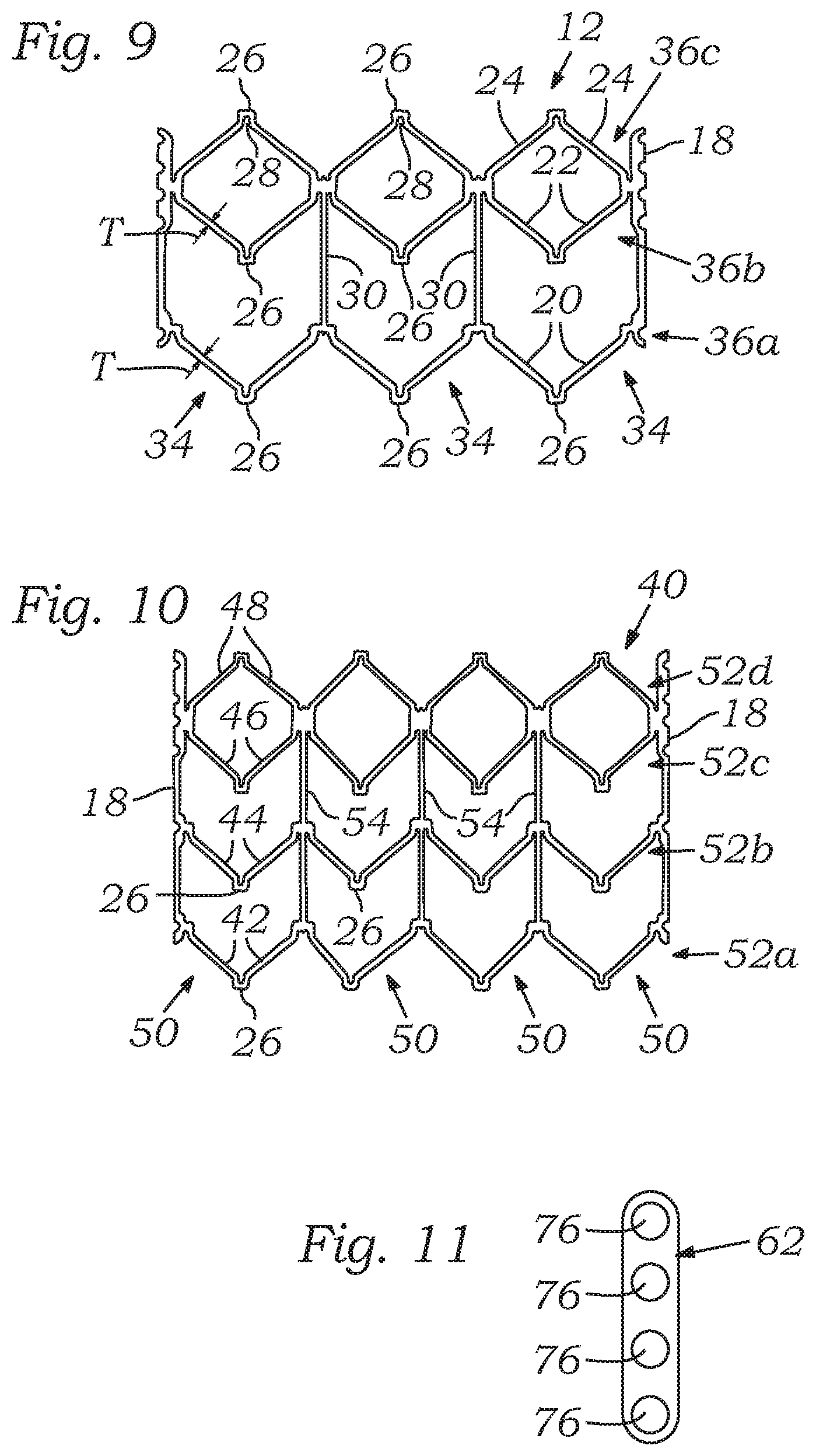 Patent US12588987 Figure 6 – Low profile transcatheter heart valve