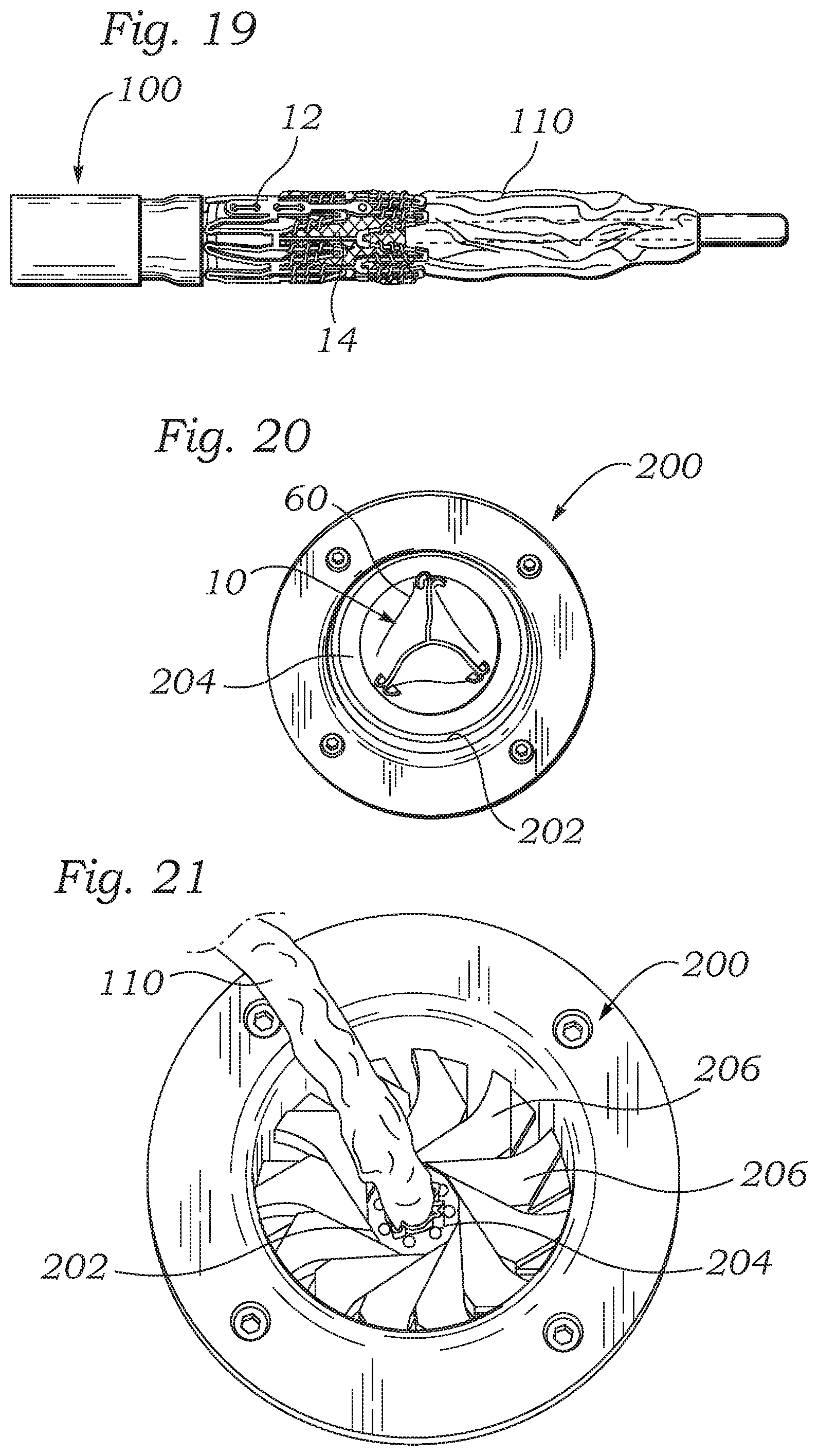 Patent US12588987 Figure 8 – Low profile transcatheter heart valve