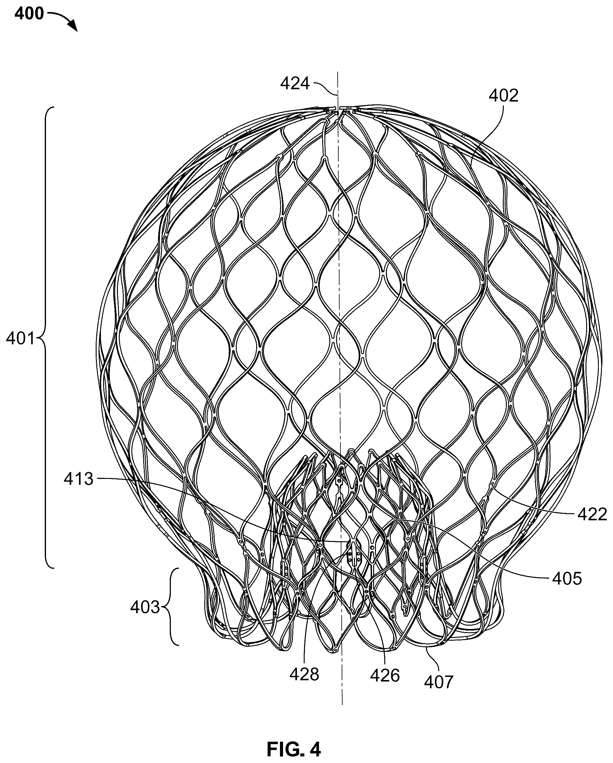 Patent US12588988 Figure 4 – Implant delivery