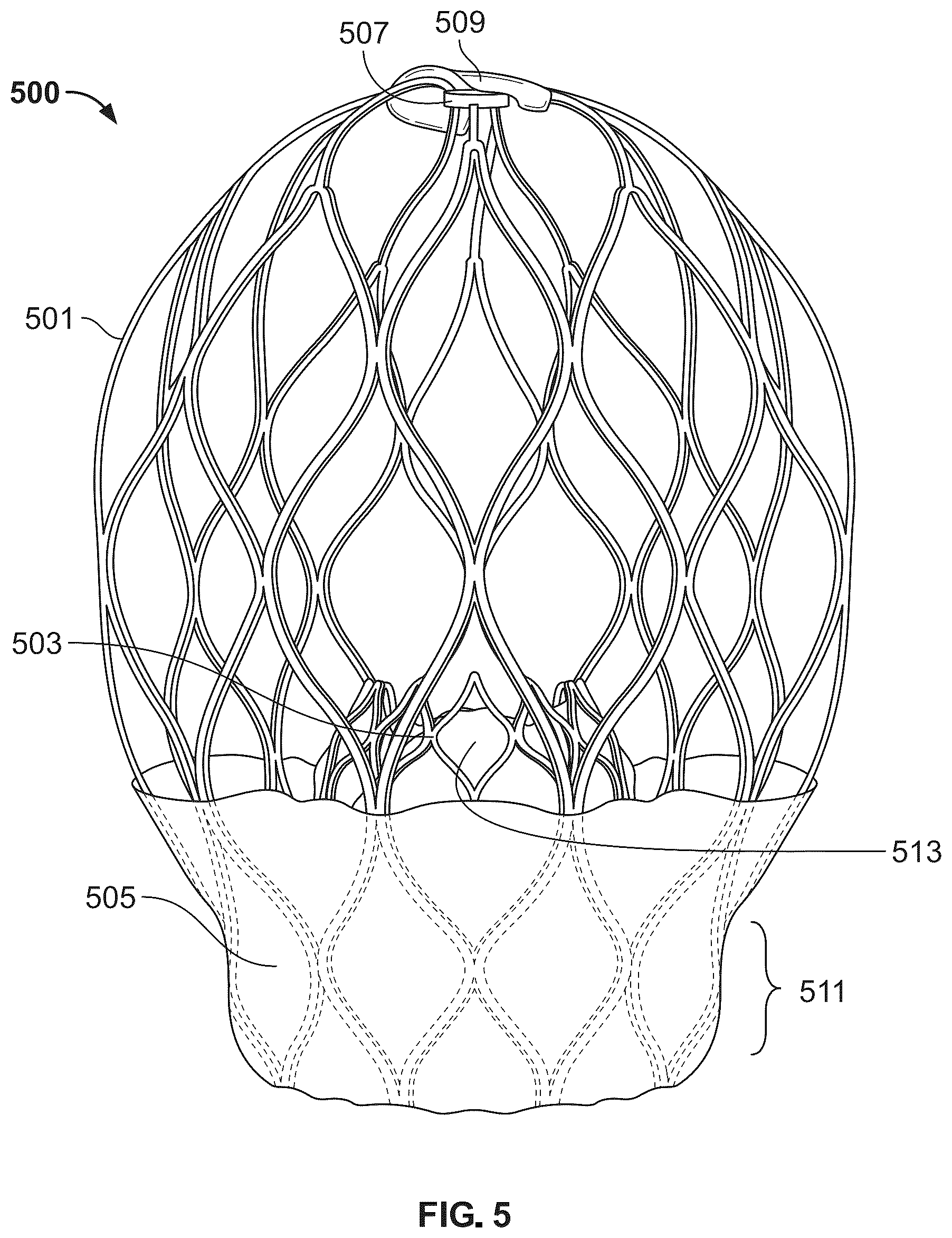 Patent US12588988 Figure 5 – Implant delivery