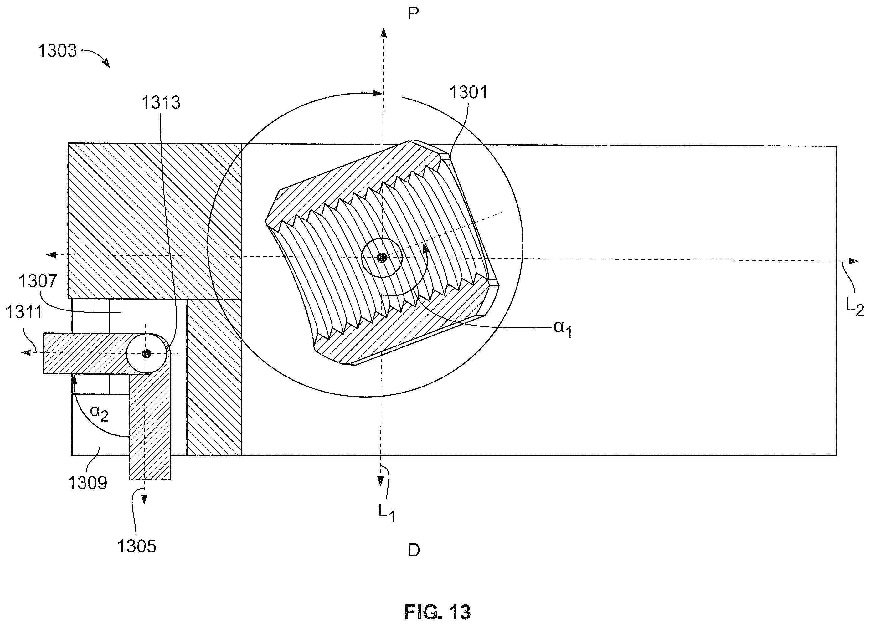 Patent US12588988 Figure 11 – Implant delivery