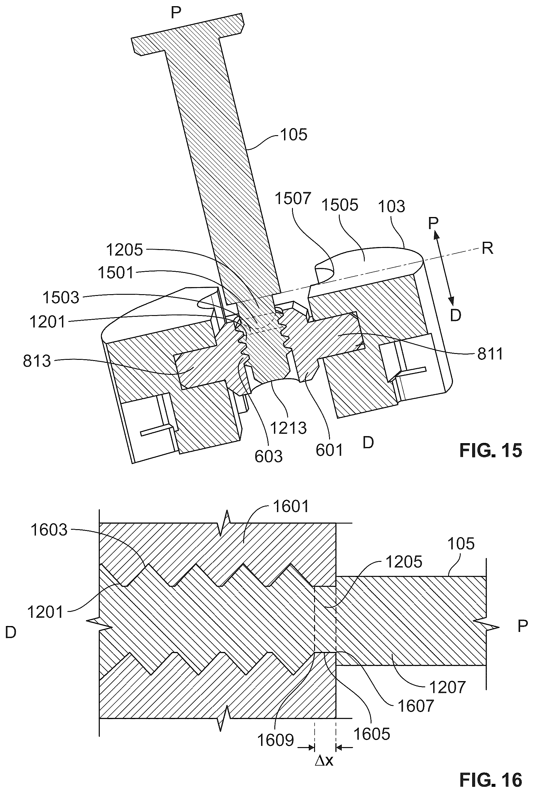 Patent US12588988 Figure 13 – Implant delivery