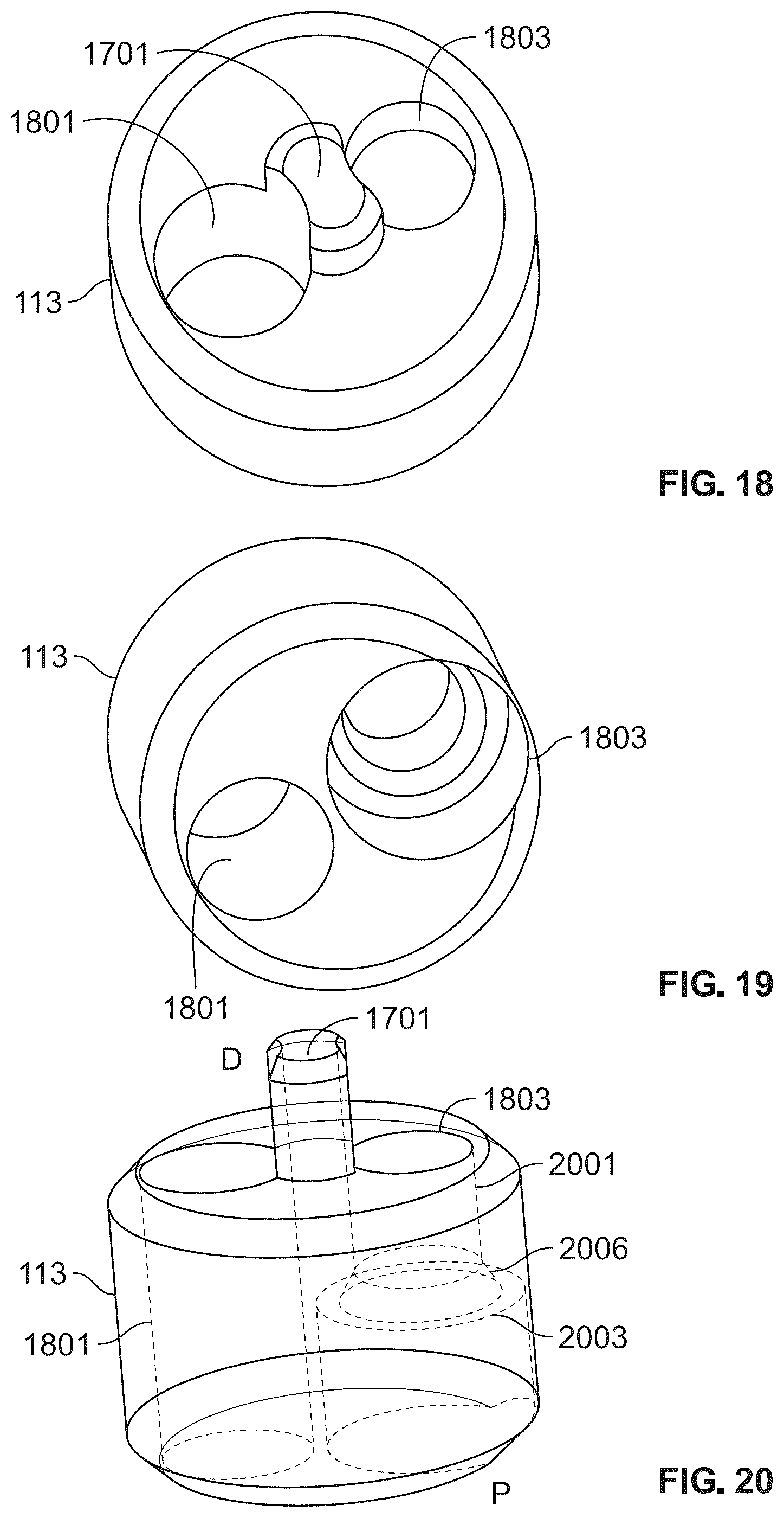 Patent US12588988 Figure 15 – Implant delivery