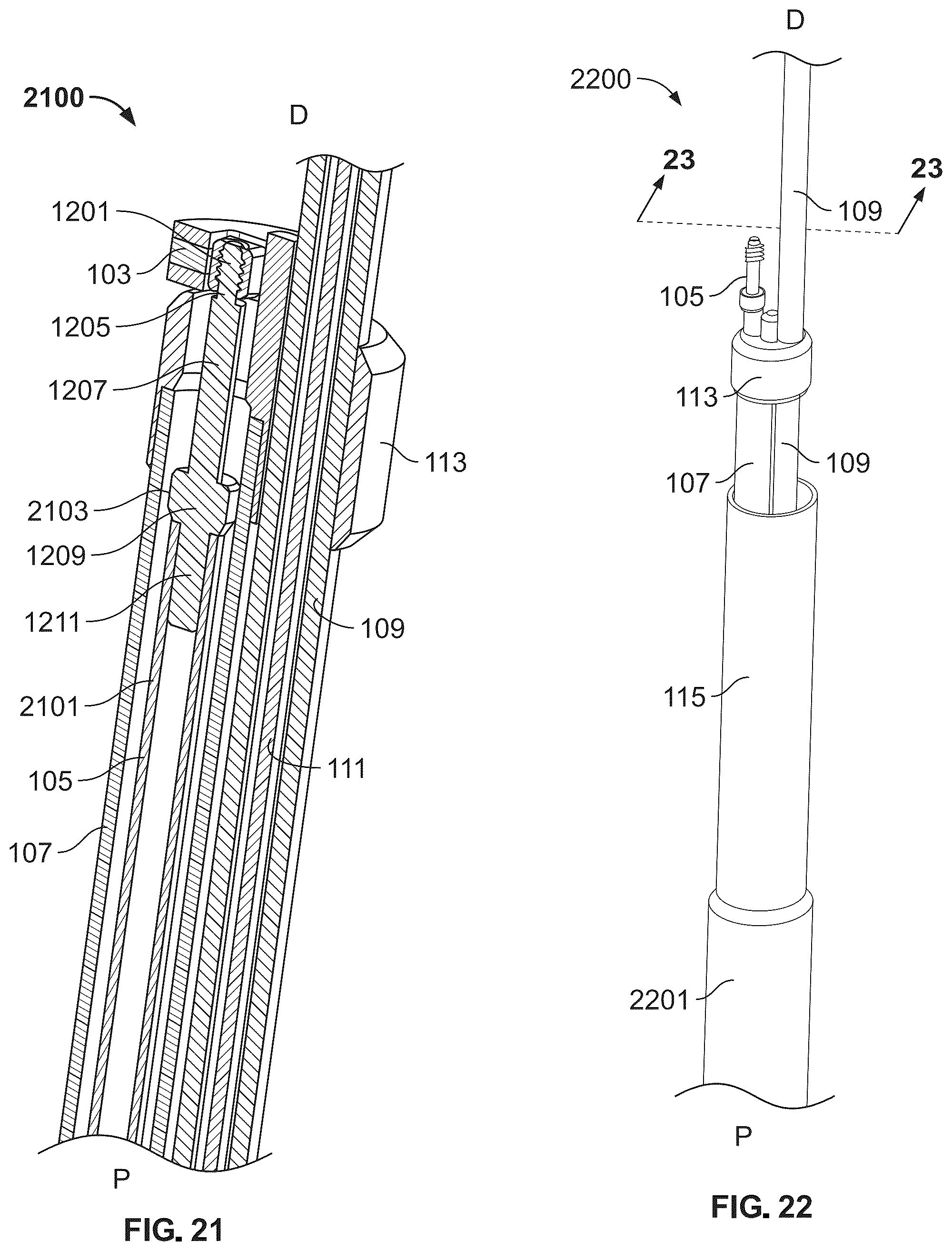 Patent US12588988 Figure 16 – Implant delivery