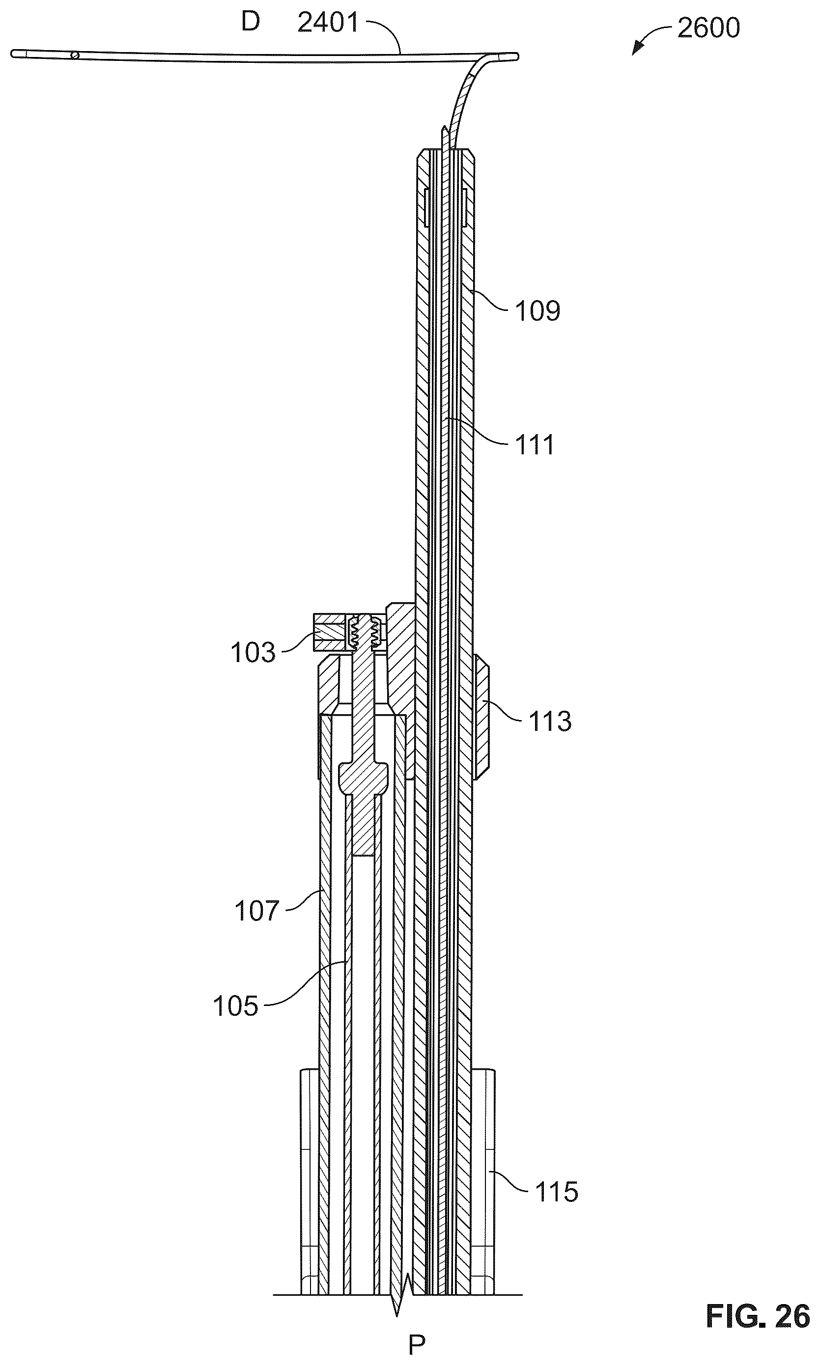 Patent US12588988 Figure 19 – Implant delivery