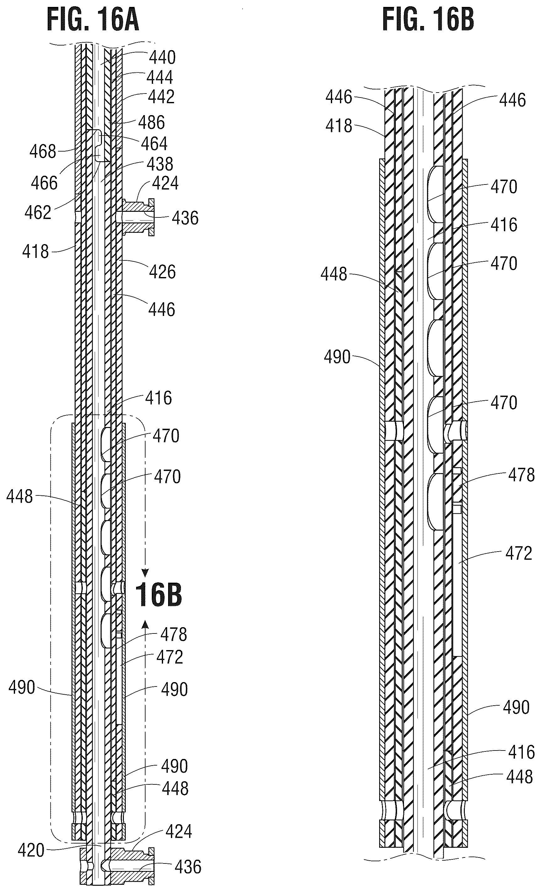 Patent US12588990 Figure 11 – Delivery apparatus for a prosthetic heart valve
