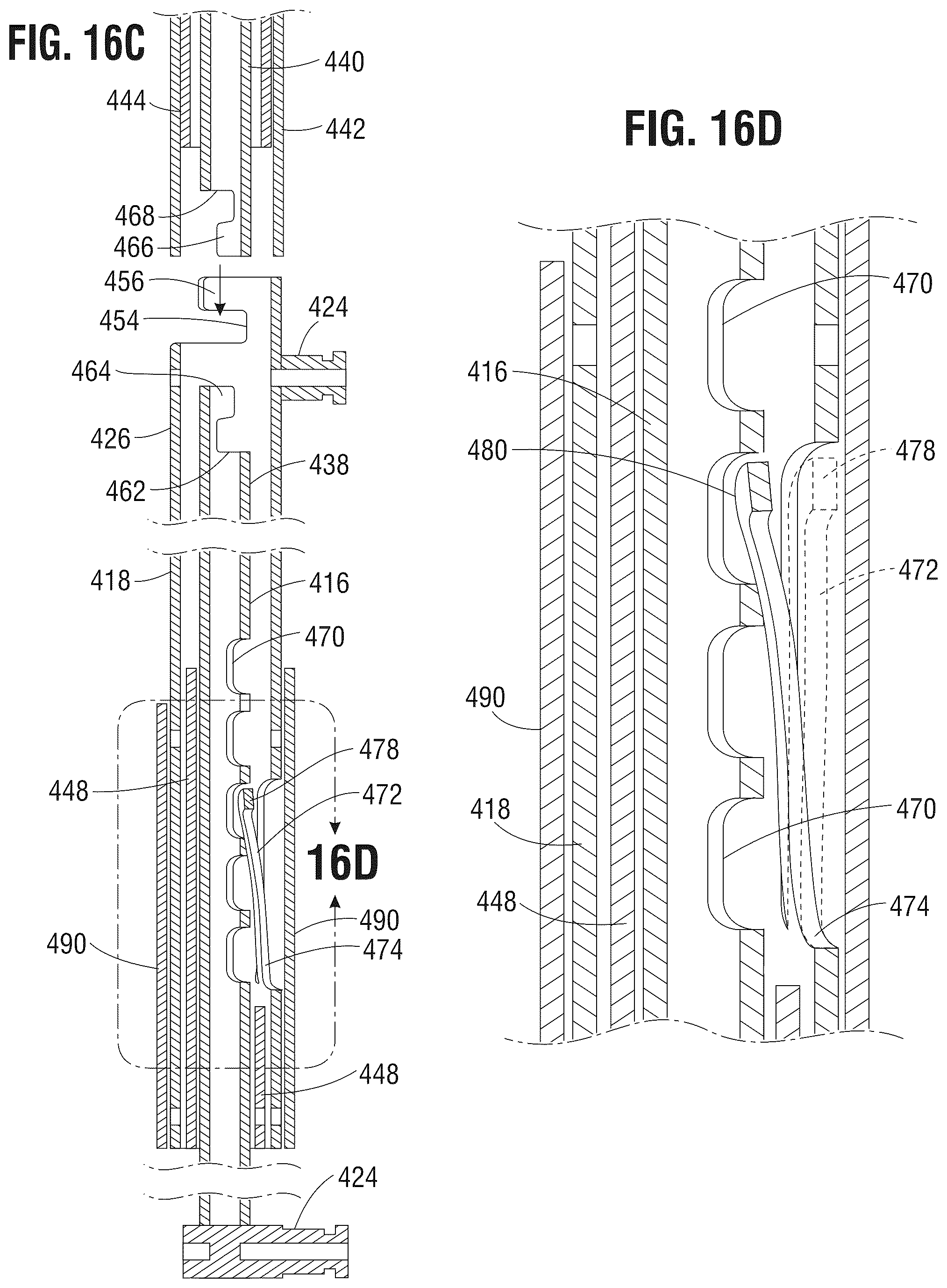 Patent US12588990 Figure 12 – Delivery apparatus for a prosthetic heart valve