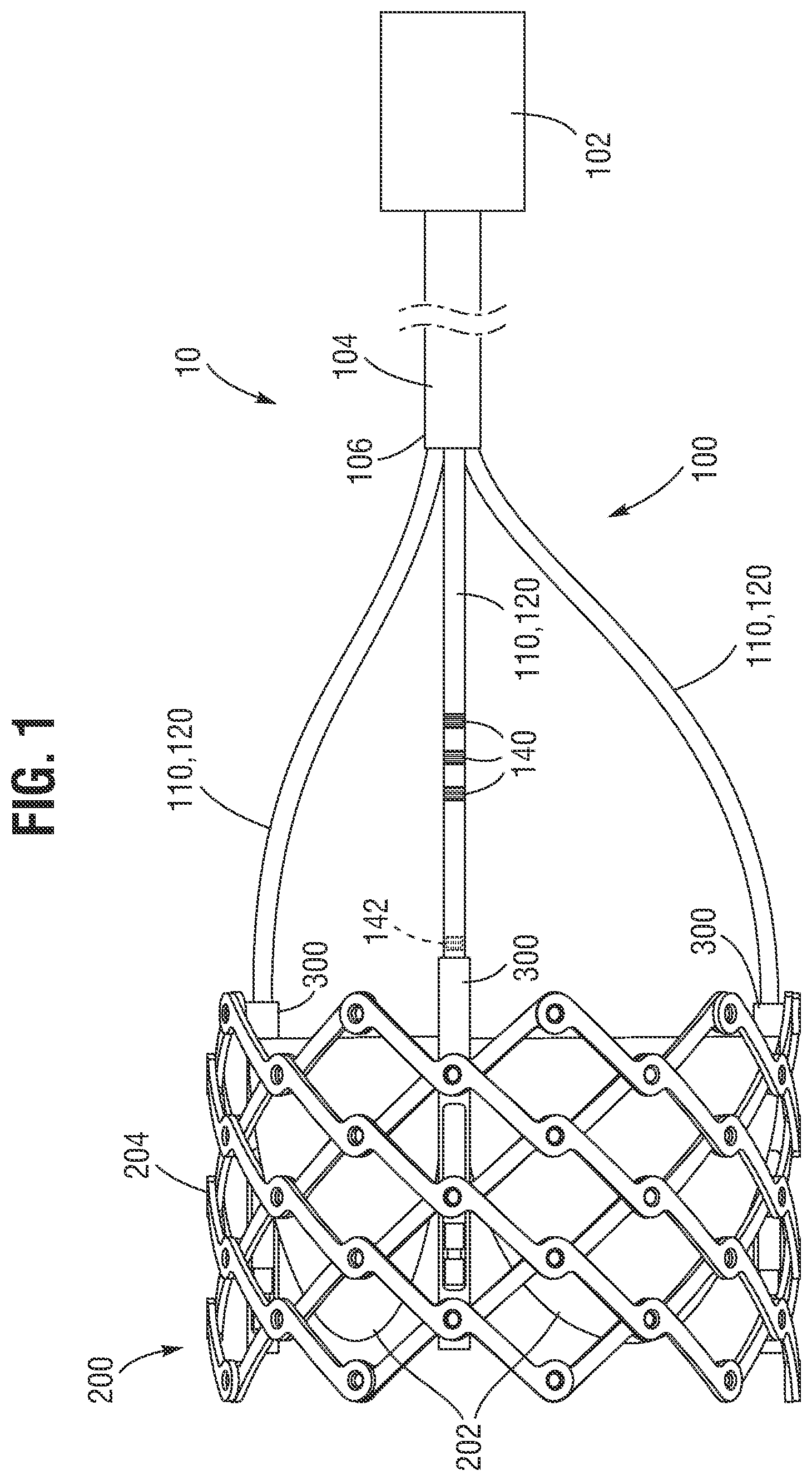 Patent US12588991 — Apparatus and method for monitoring valve expansion — Figure 1