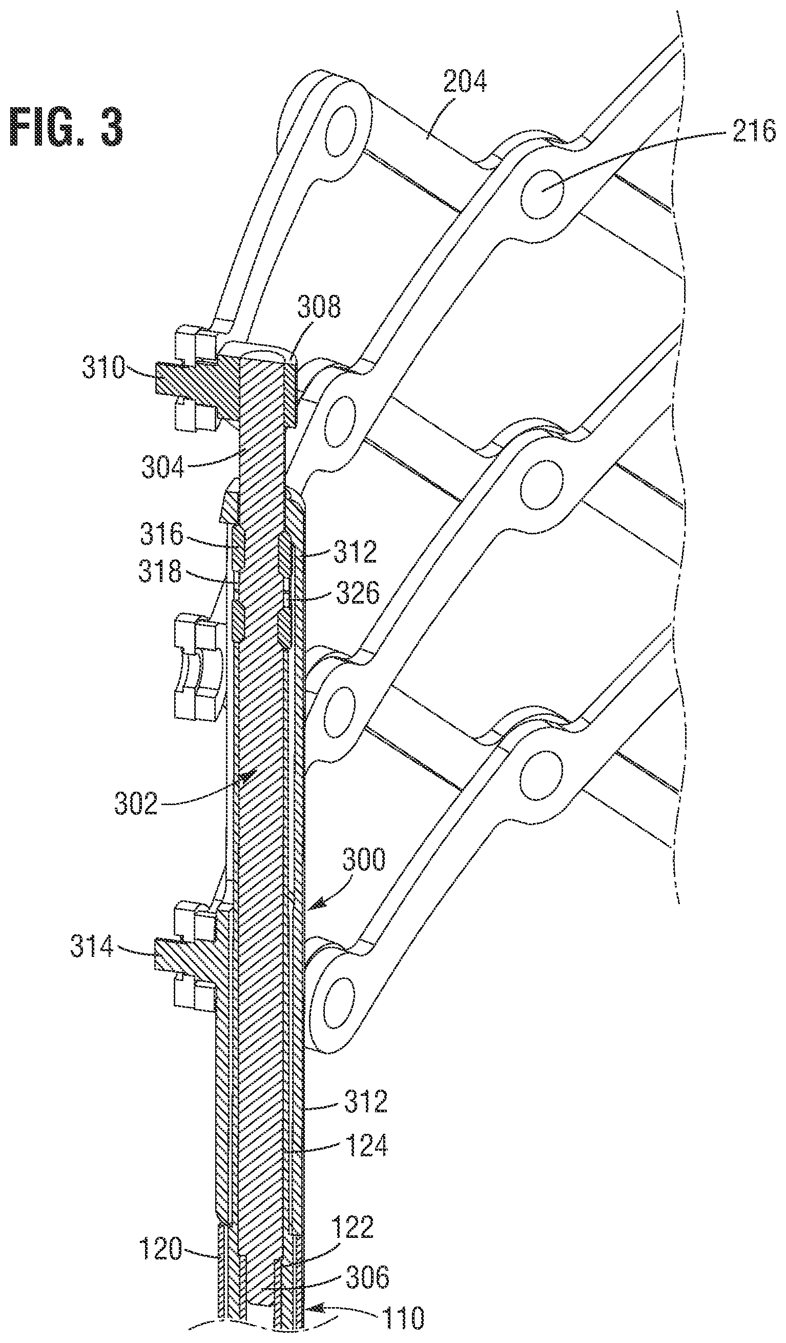 Patent US12588991 Figure 3 – Apparatus and method for monitoring valve expansion
