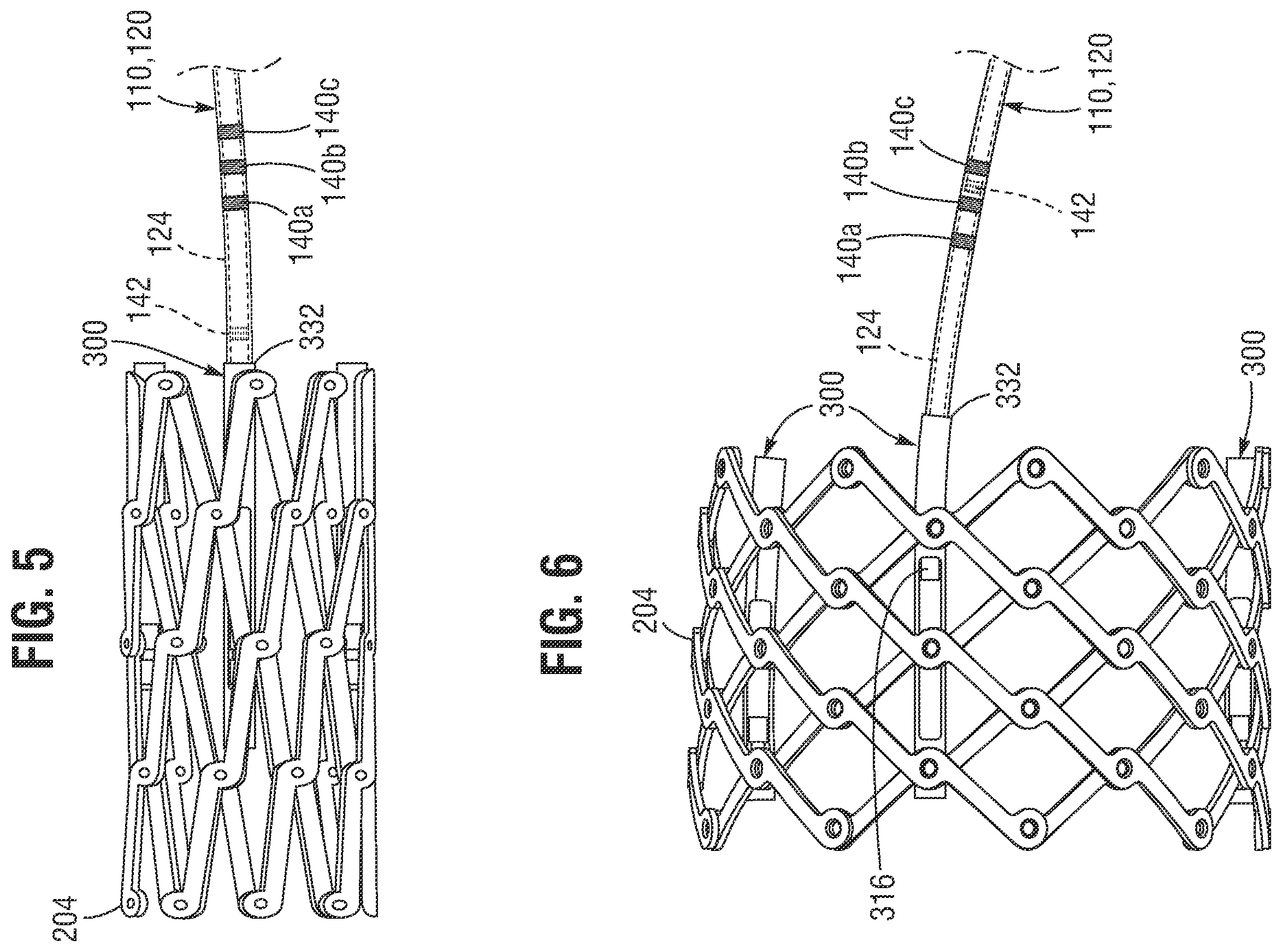 Patent US12588991 Figure 5 – Apparatus and method for monitoring valve expansion
