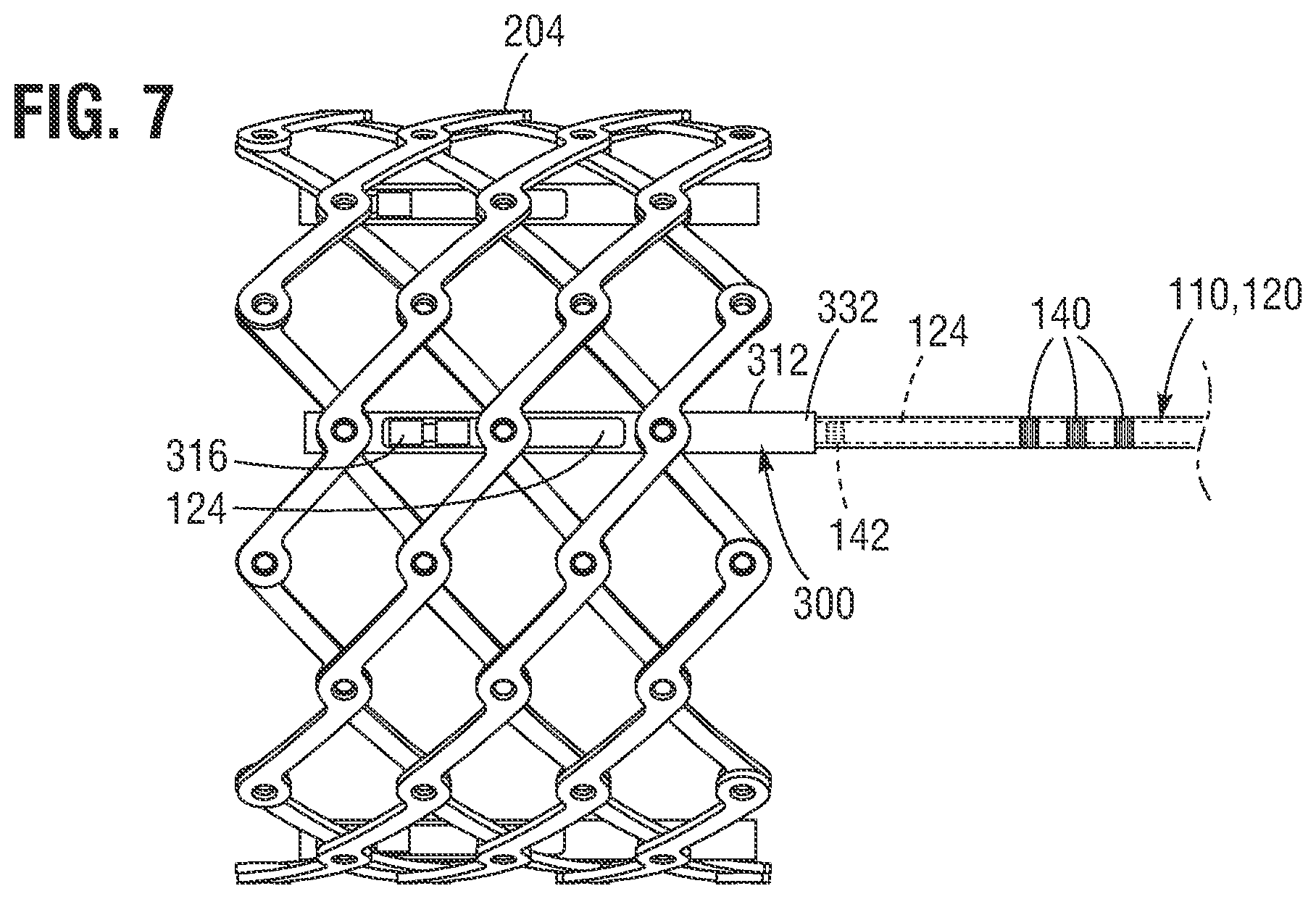 Patent US12588991 Figure 6 – Apparatus and method for monitoring valve expansion