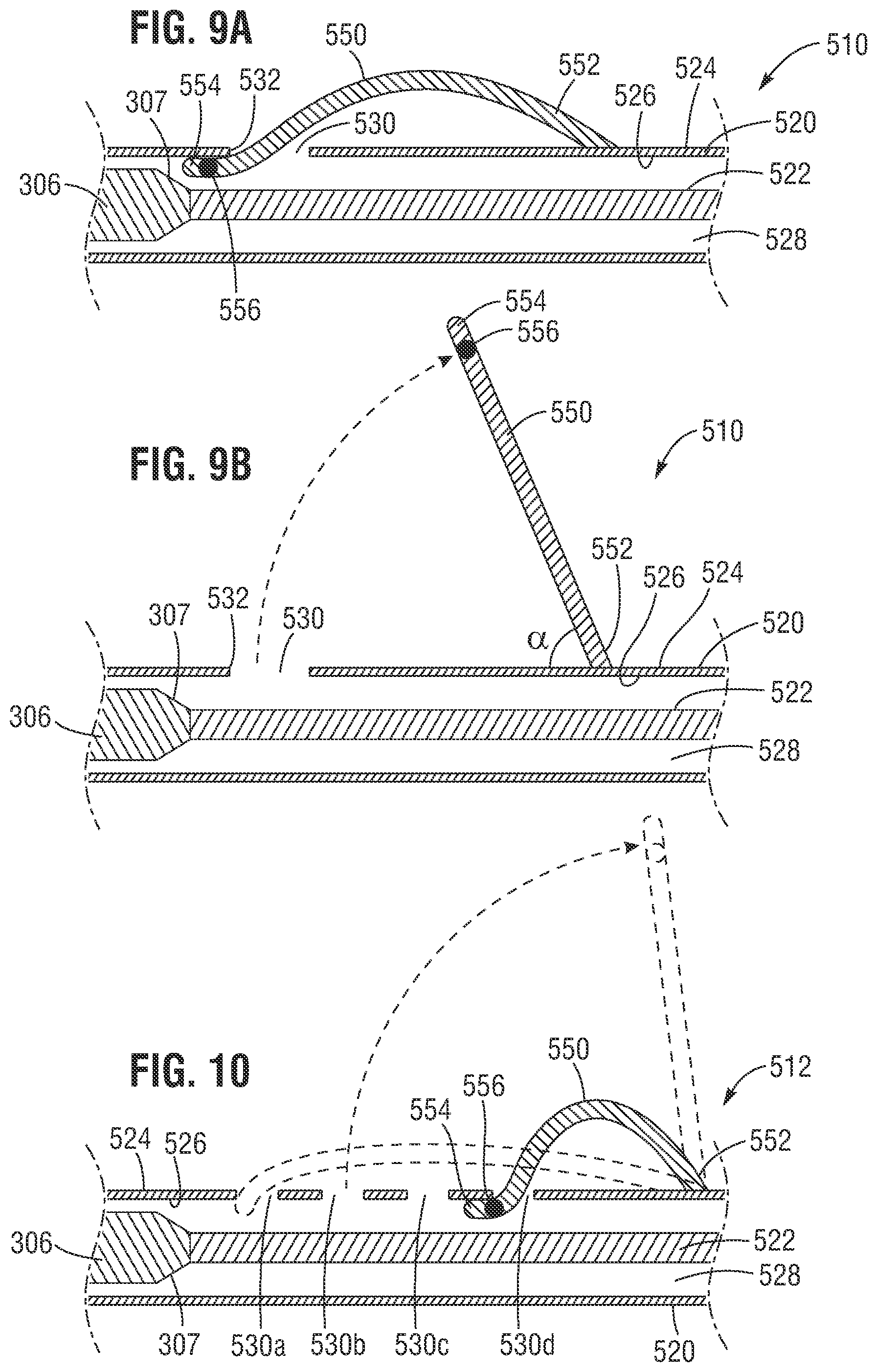 Patent US12588991 Figure 8 – Apparatus and method for monitoring valve expansion