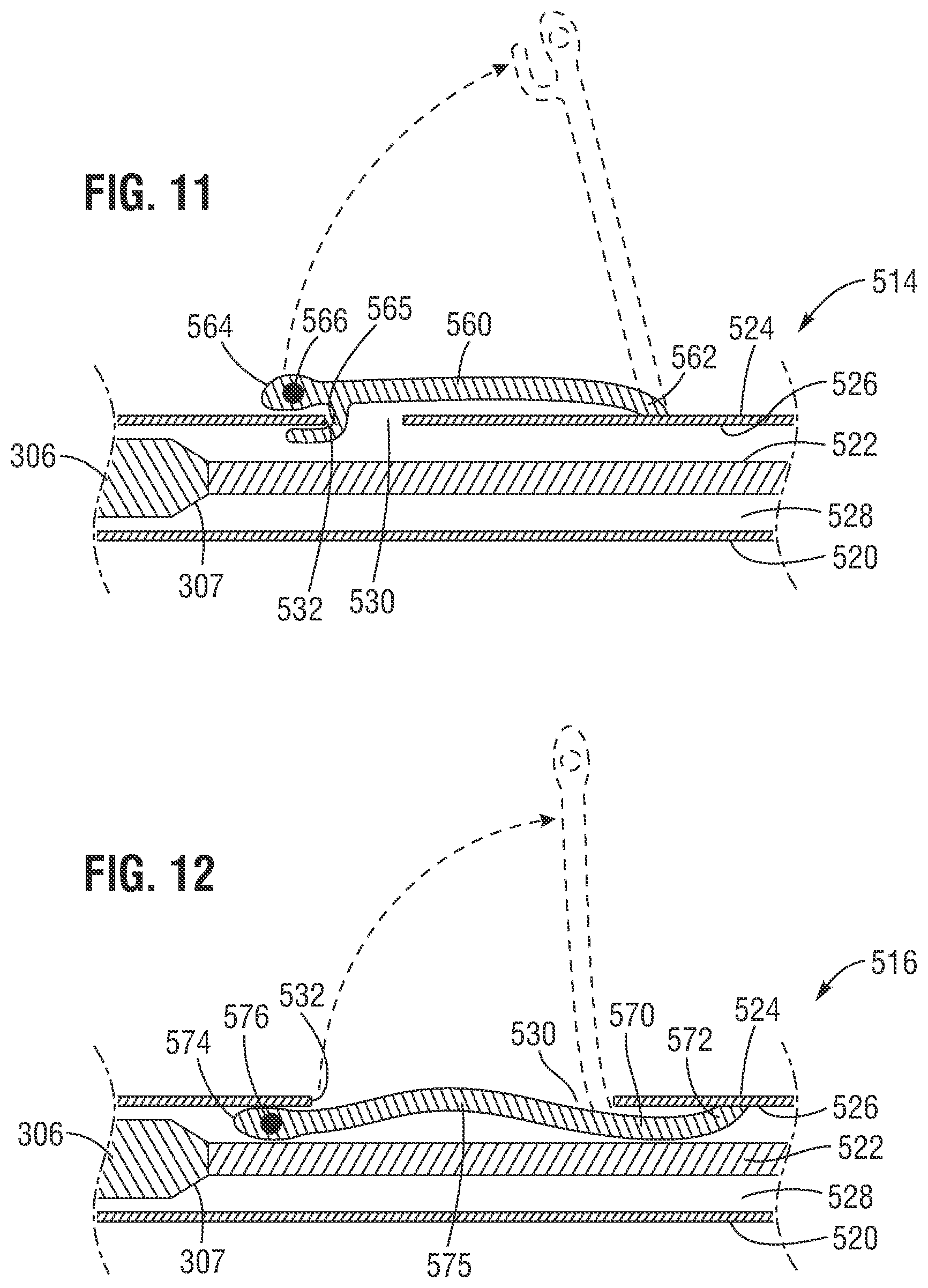 Patent US12588991 Figure 9 – Apparatus and method for monitoring valve expansion