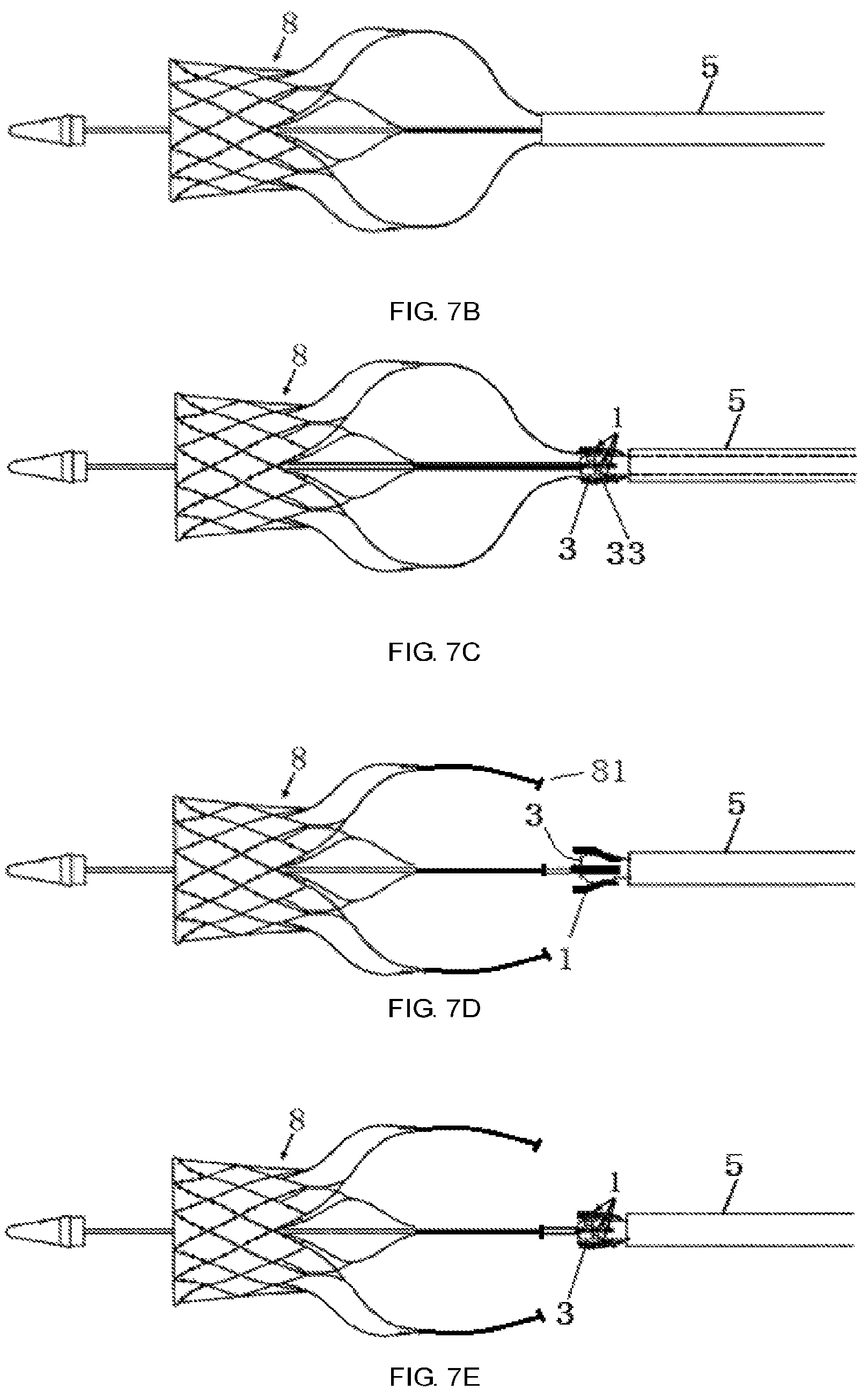 Patent US12588992 Figure 4 – Easy-to-control interventional instrument delivery device