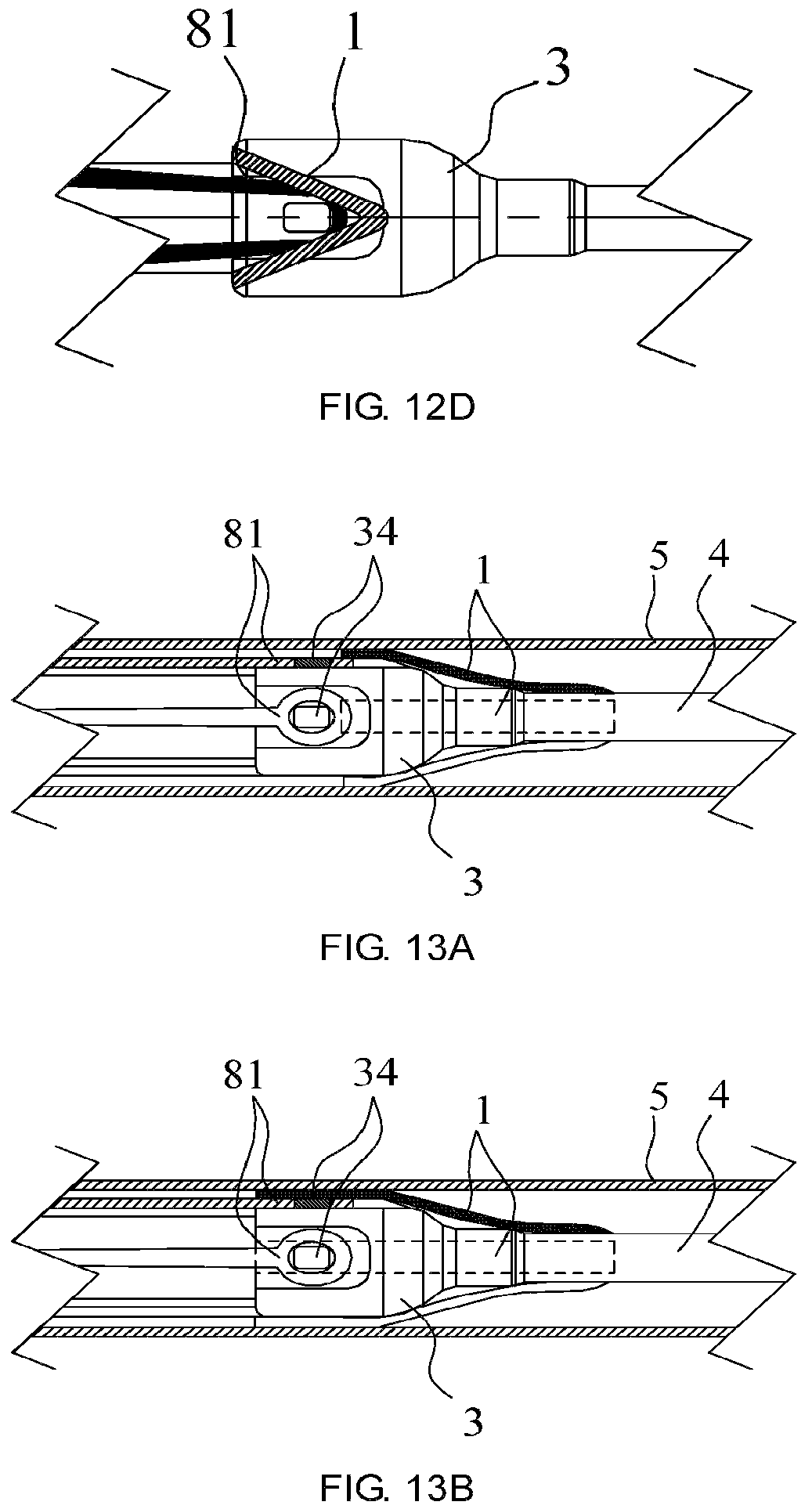 Patent US12588992 Figure 8 – Easy-to-control interventional instrument delivery device