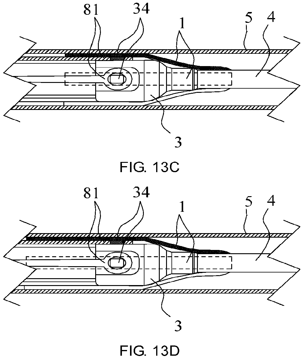 Patent US12588992 Figure 9 – Easy-to-control interventional instrument delivery device