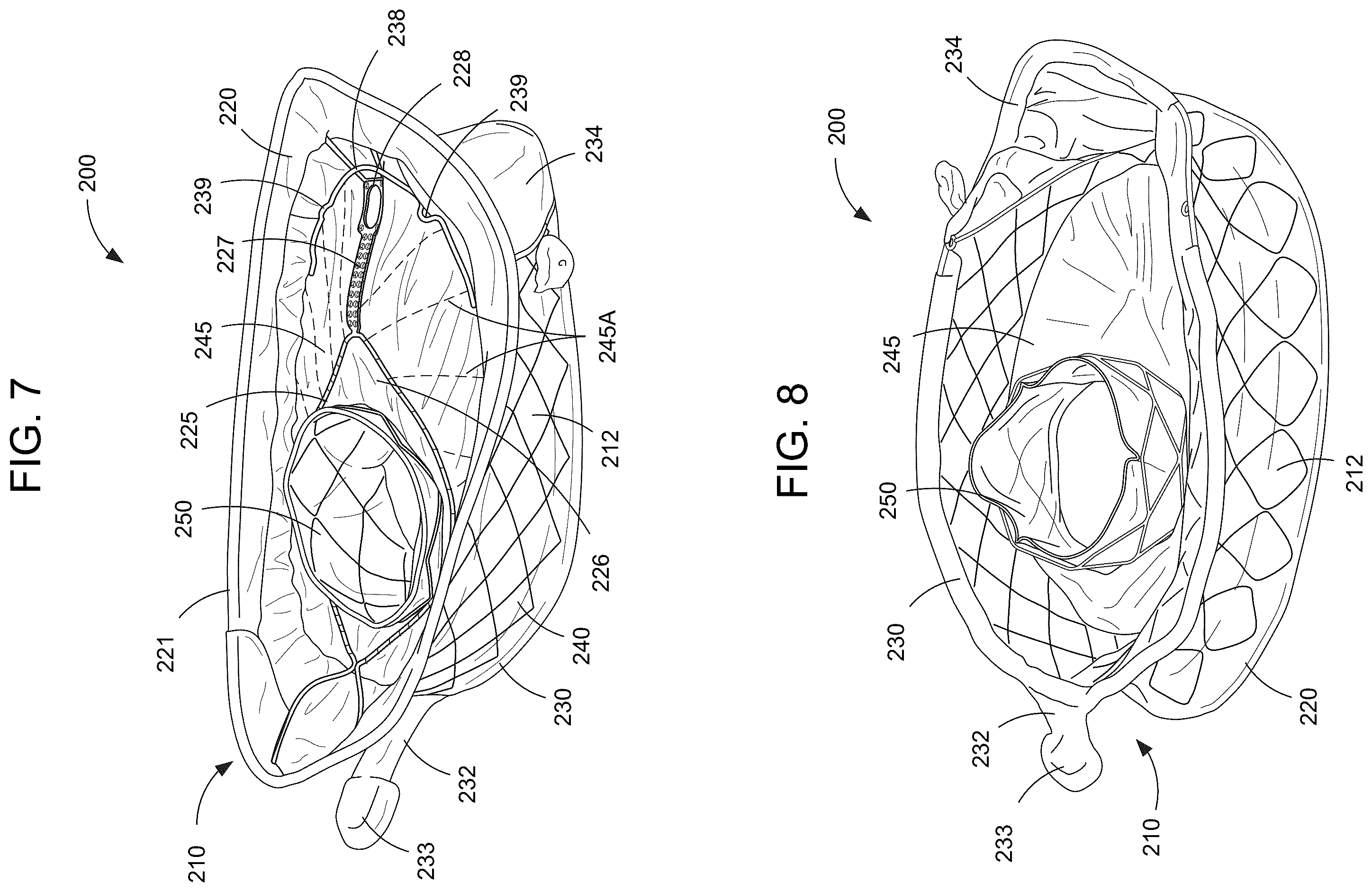 Patent US12588993 Figure 4 – Devices and methods for delivering a prosthetic heart valve using supra-annular support