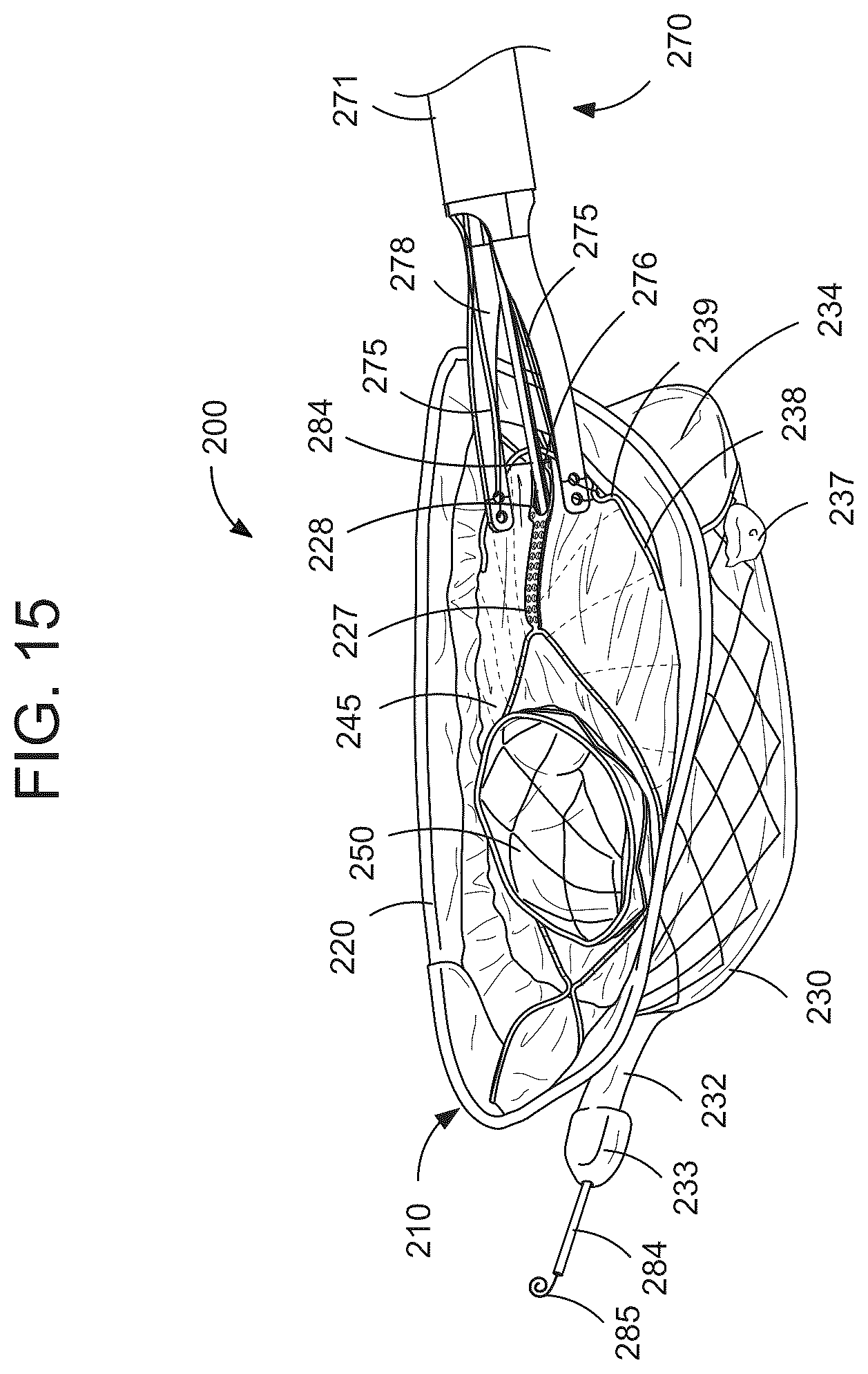 Patent US12588993 Figure 7 – Devices and methods for delivering a prosthetic heart valve using supra-annular support
