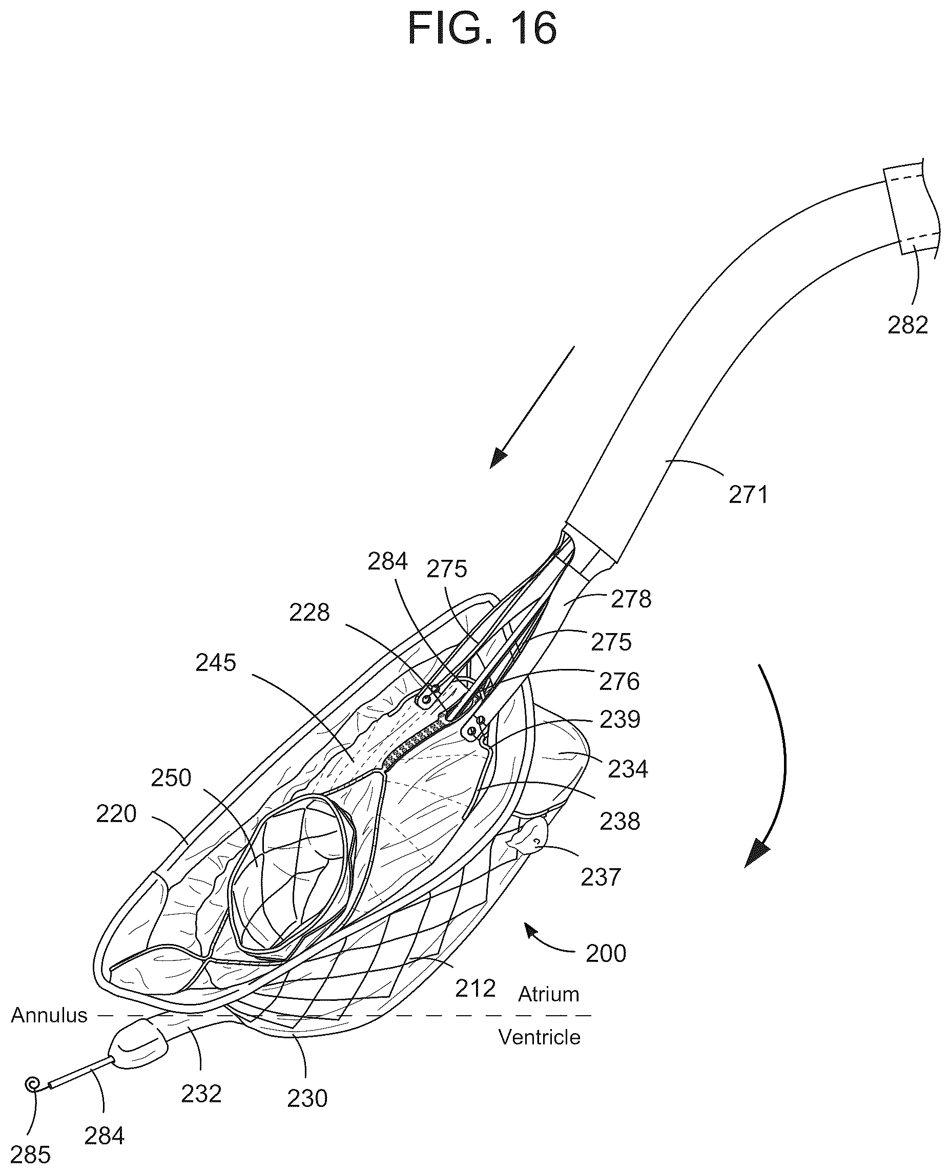 Patent US12588993 Figure 8 – Devices and methods for delivering a prosthetic heart valve using supra-annular support