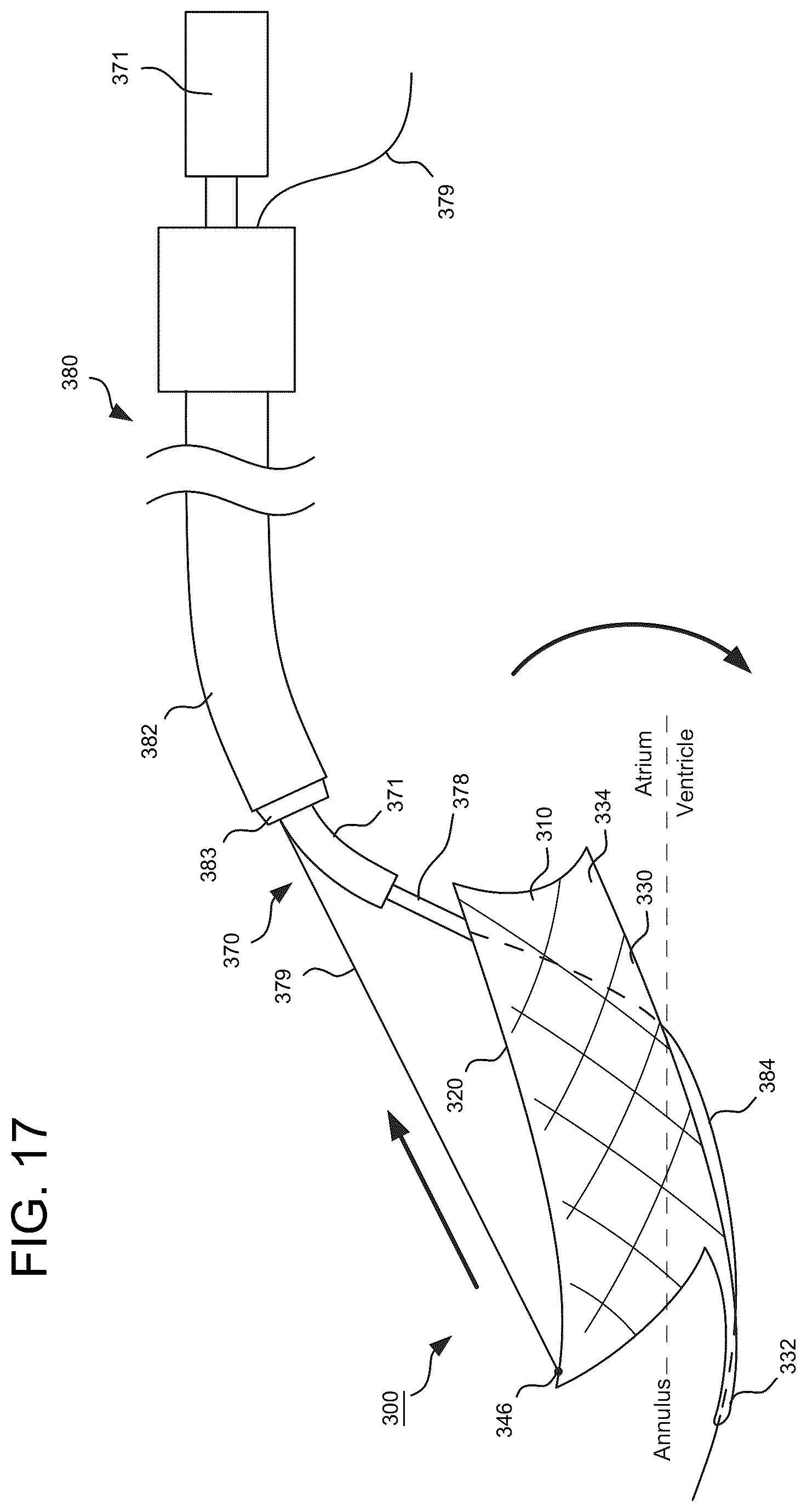 Patent US12588993 Figure 9 – Devices and methods for delivering a prosthetic heart valve using supra-annular support