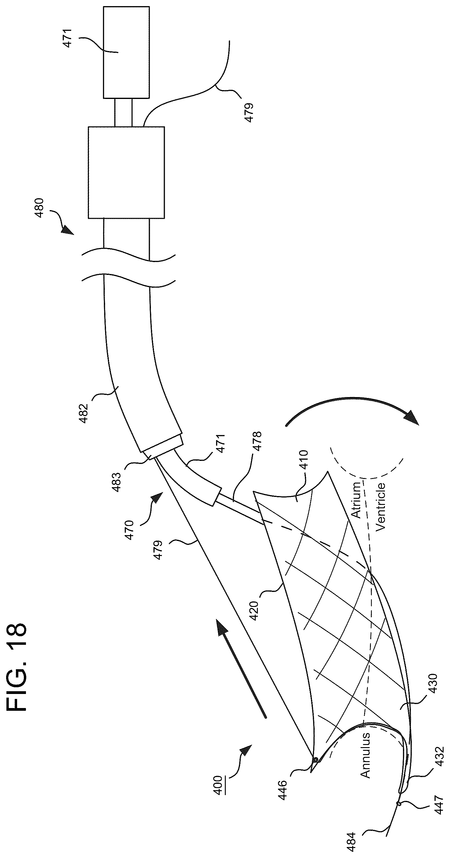 Patent US12588993 Figure 10 – Devices and methods for delivering a prosthetic heart valve using supra-annular support