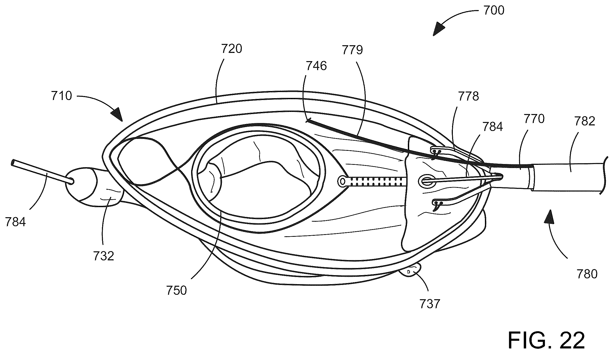 Patent US12588993 Figure 13 – Devices and methods for delivering a prosthetic heart valve using supra-annular support