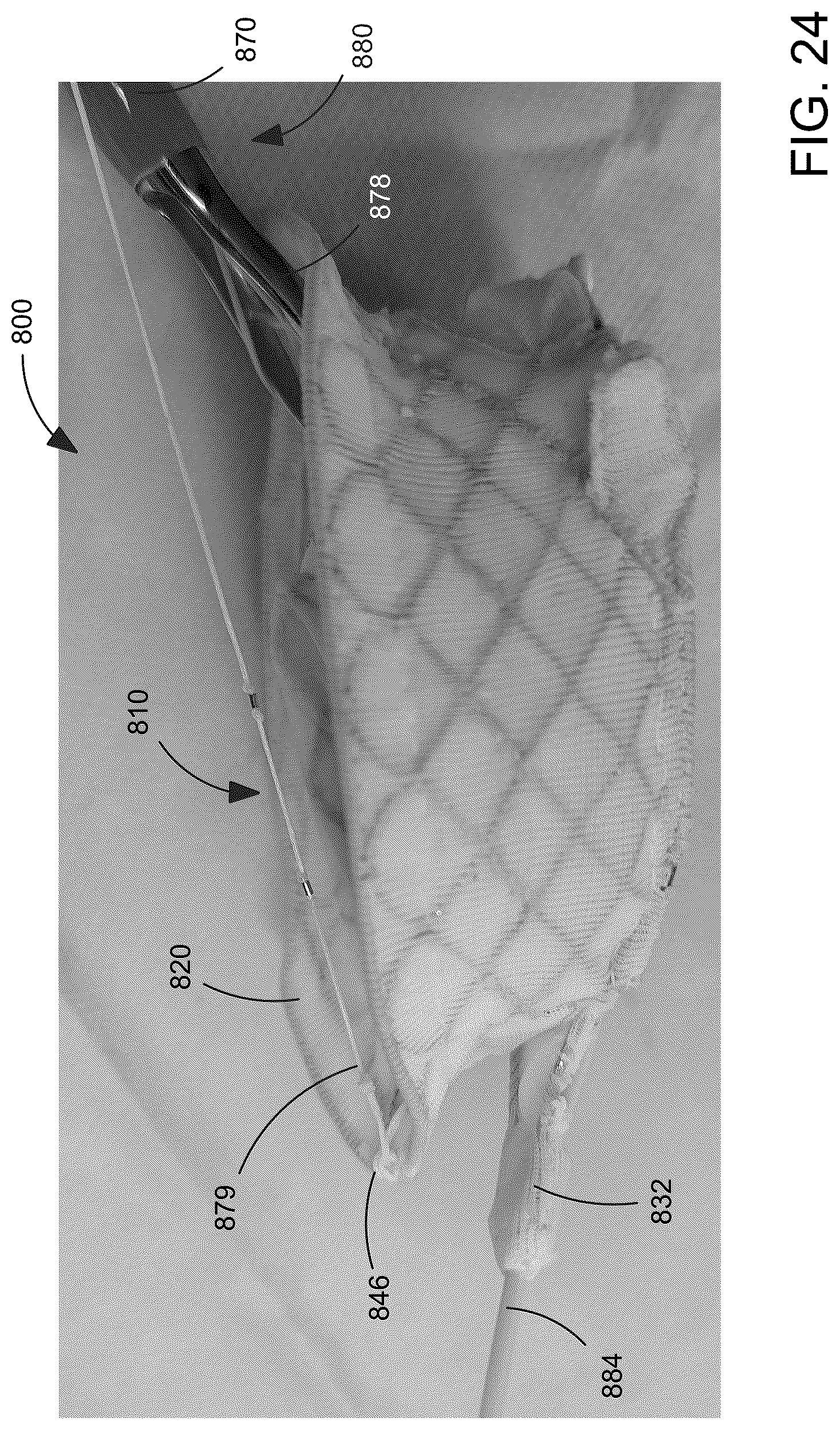 Patent US12588993 Figure 15 – Devices and methods for delivering a prosthetic heart valve using supra-annular support