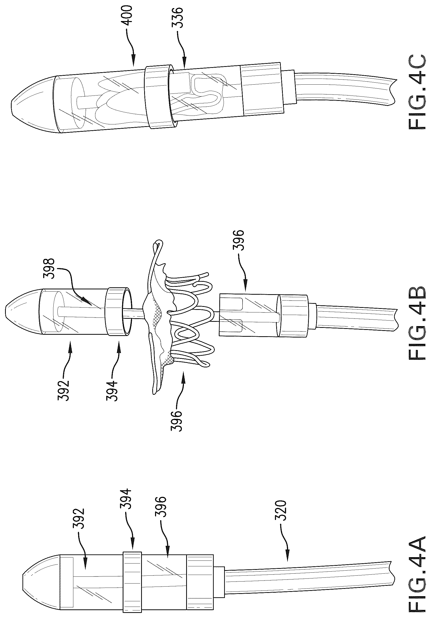 Patent US12588994 Figure 6 – Devices, systems and methods for repairing lumenal systems