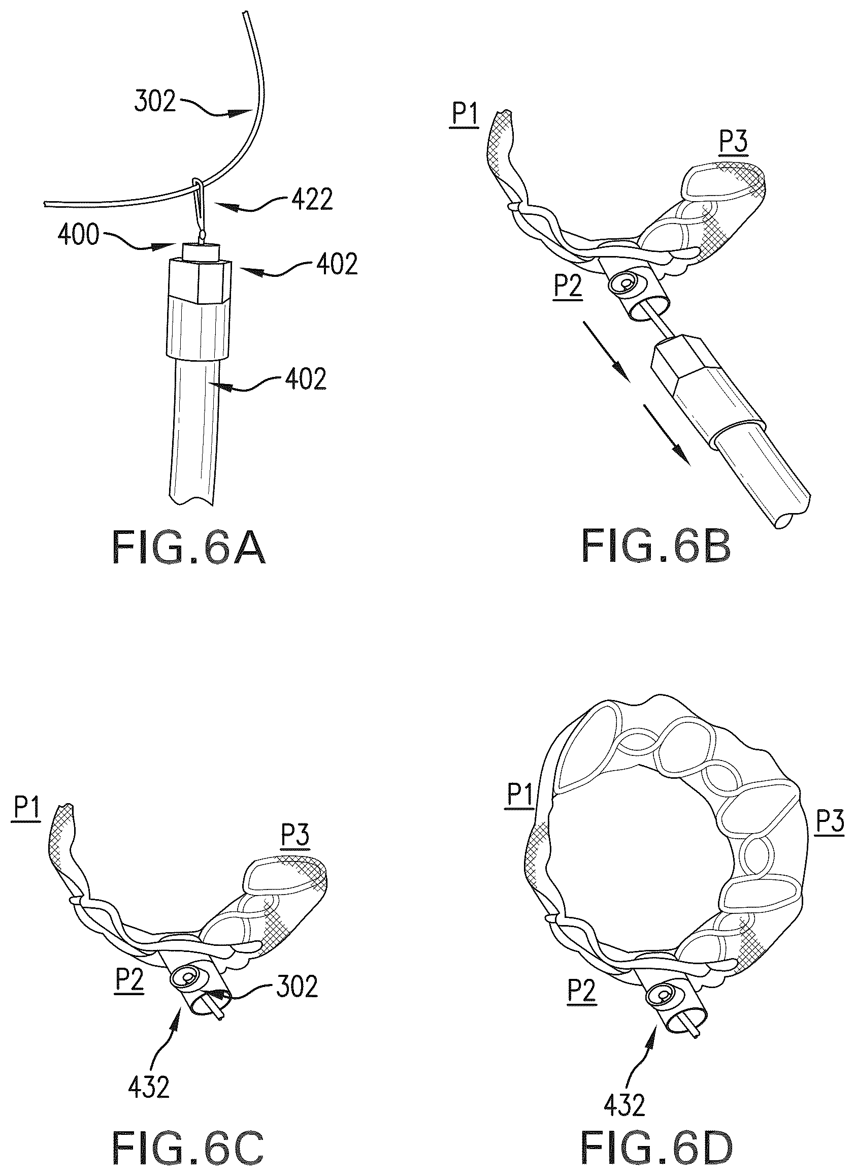 Patent US12588994 Figure 8 – Devices, systems and methods for repairing lumenal systems