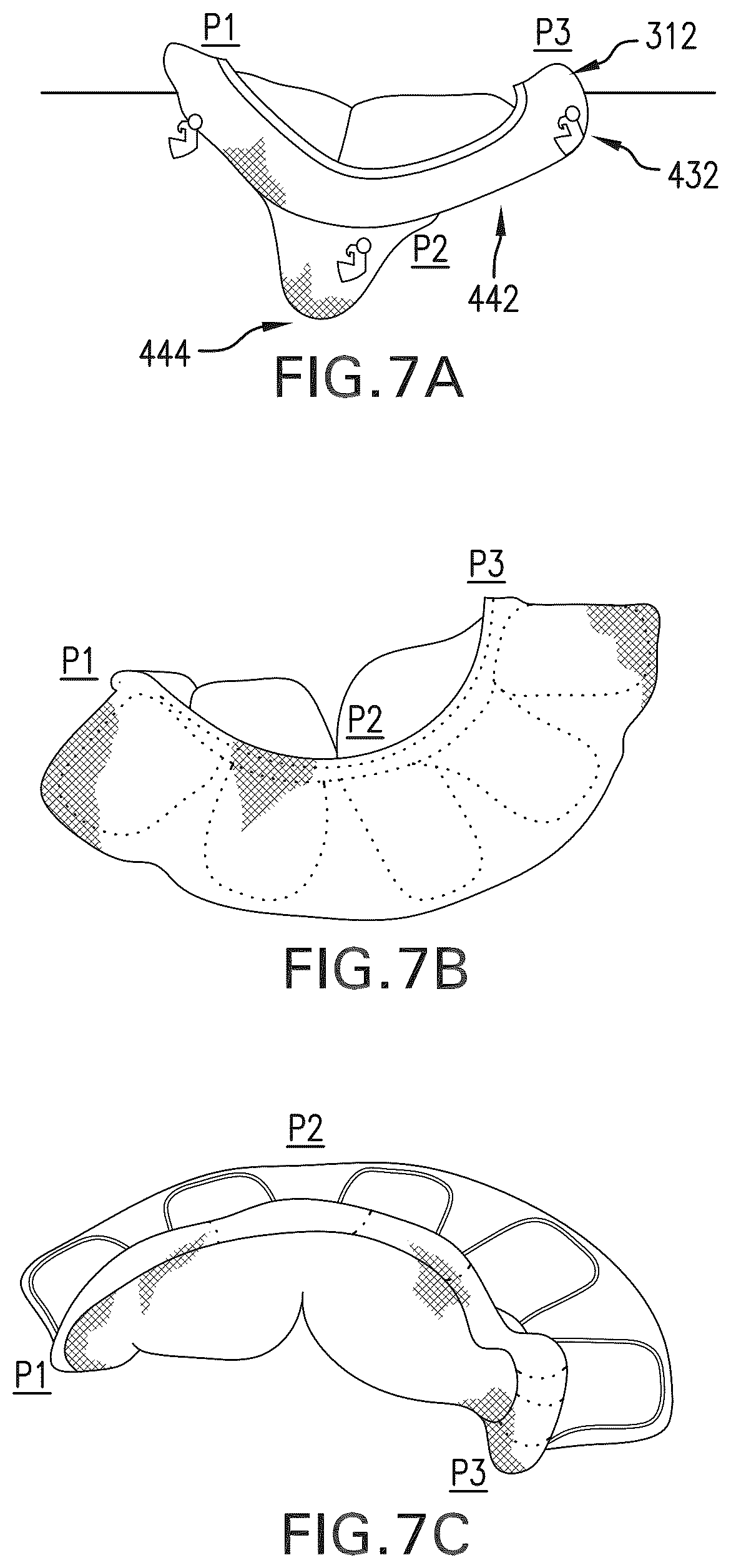 Patent US12588994 Figure 9 – Devices, systems and methods for repairing lumenal systems