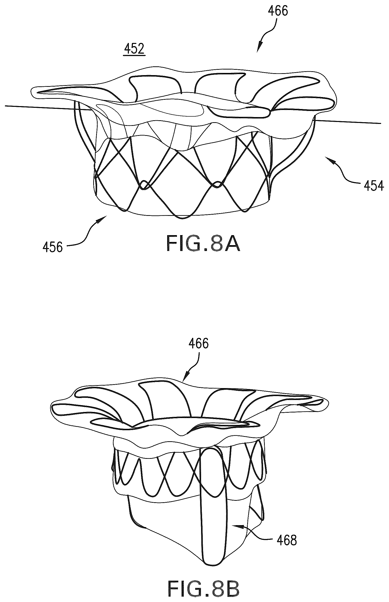 Patent US12588994 Figure 10 – Devices, systems and methods for repairing lumenal systems