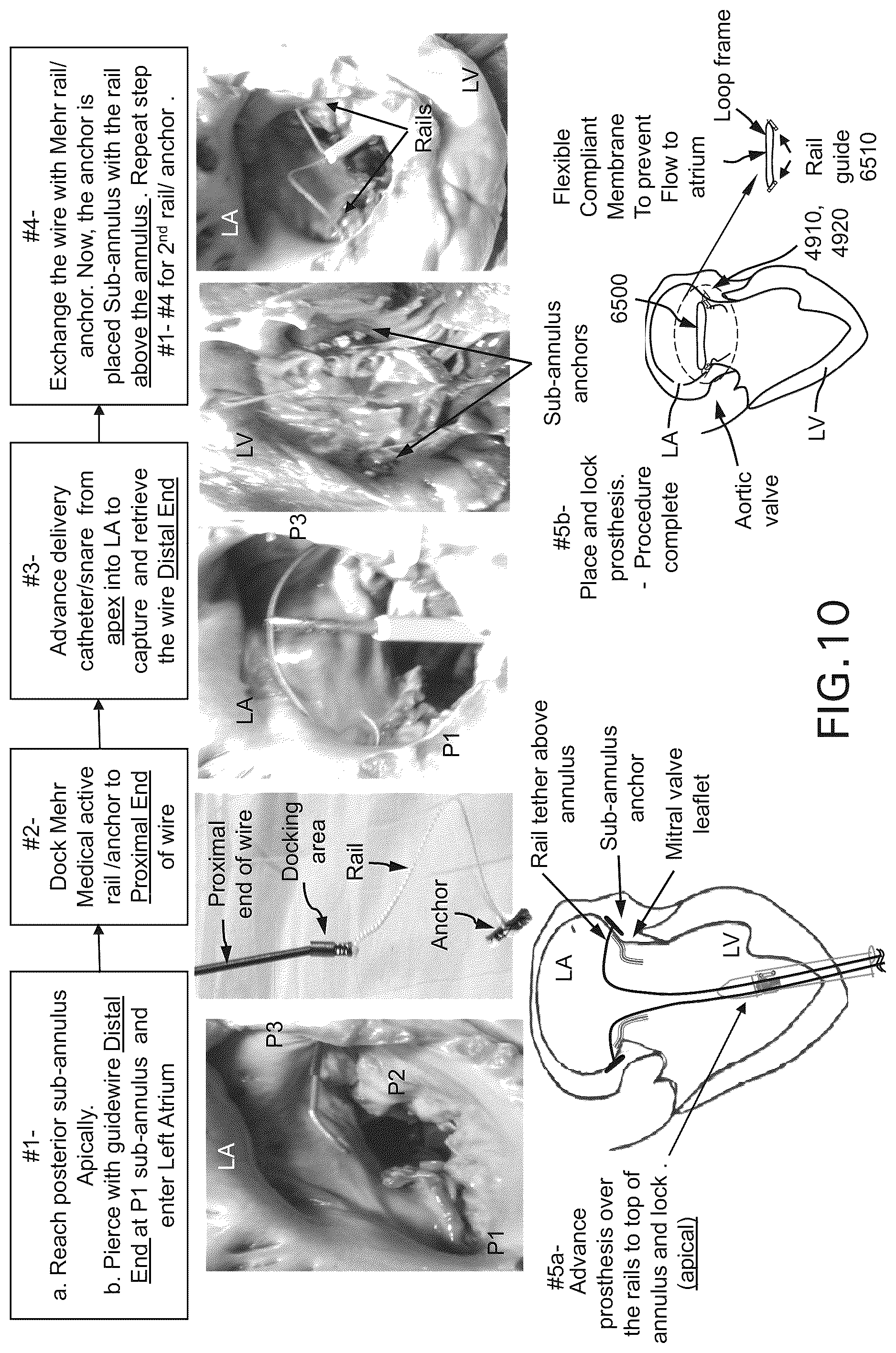 Patent US12588994 Figure 12 – Devices, systems and methods for repairing lumenal systems