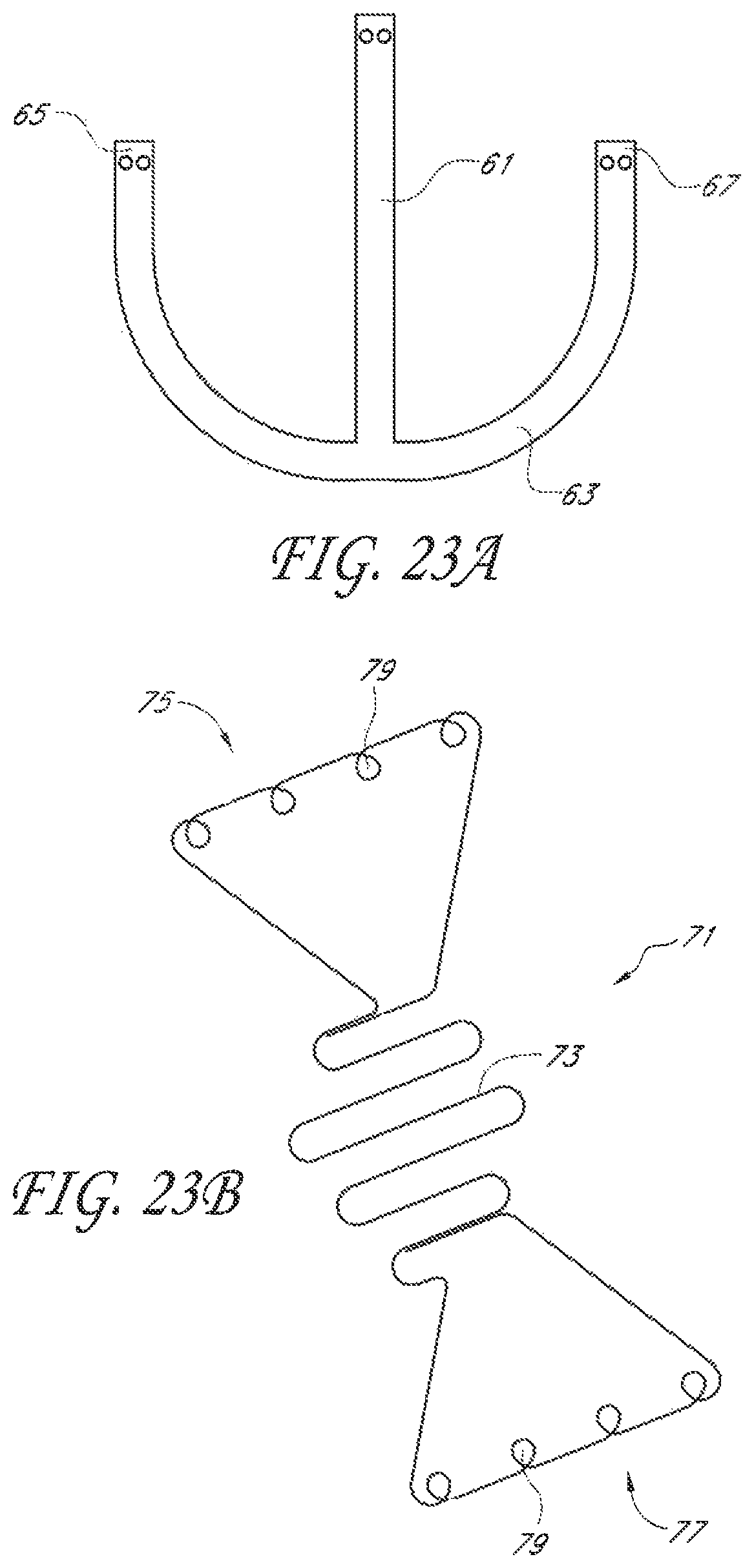 Patent US12588995 Figure 11 – Transvalvular intraanular band and chordae cutting for ischemic and dilated cardiomyopathy