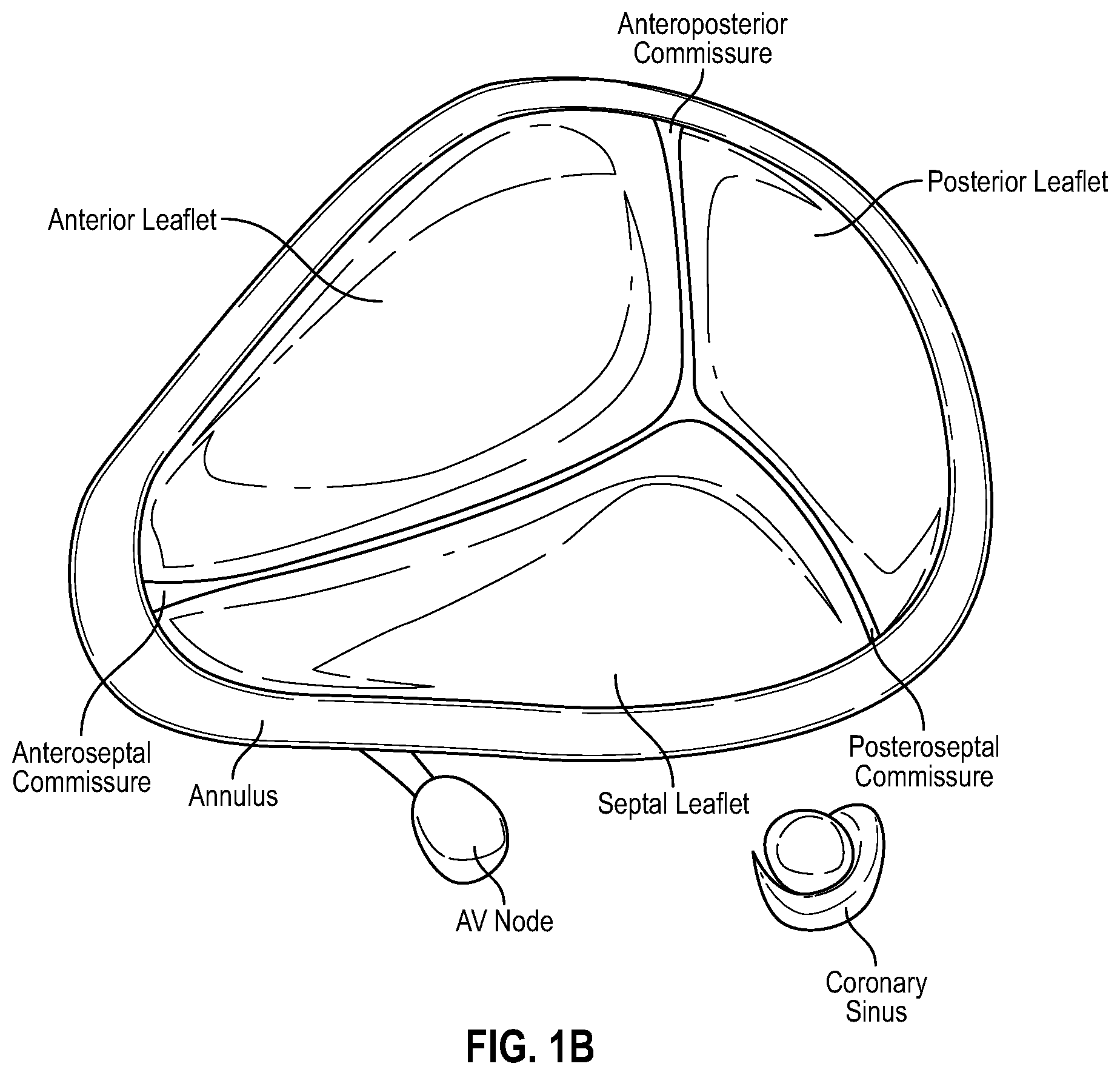 Patent US12588996 Figure 2 – Cardiac valve repair devices and associated systems and methods