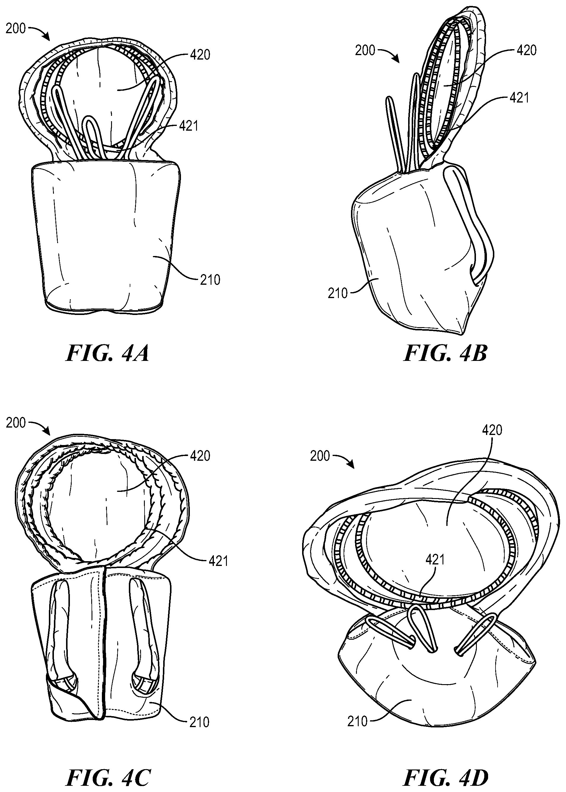 Patent US12588996 Figure 5 – Cardiac valve repair devices and associated systems and methods