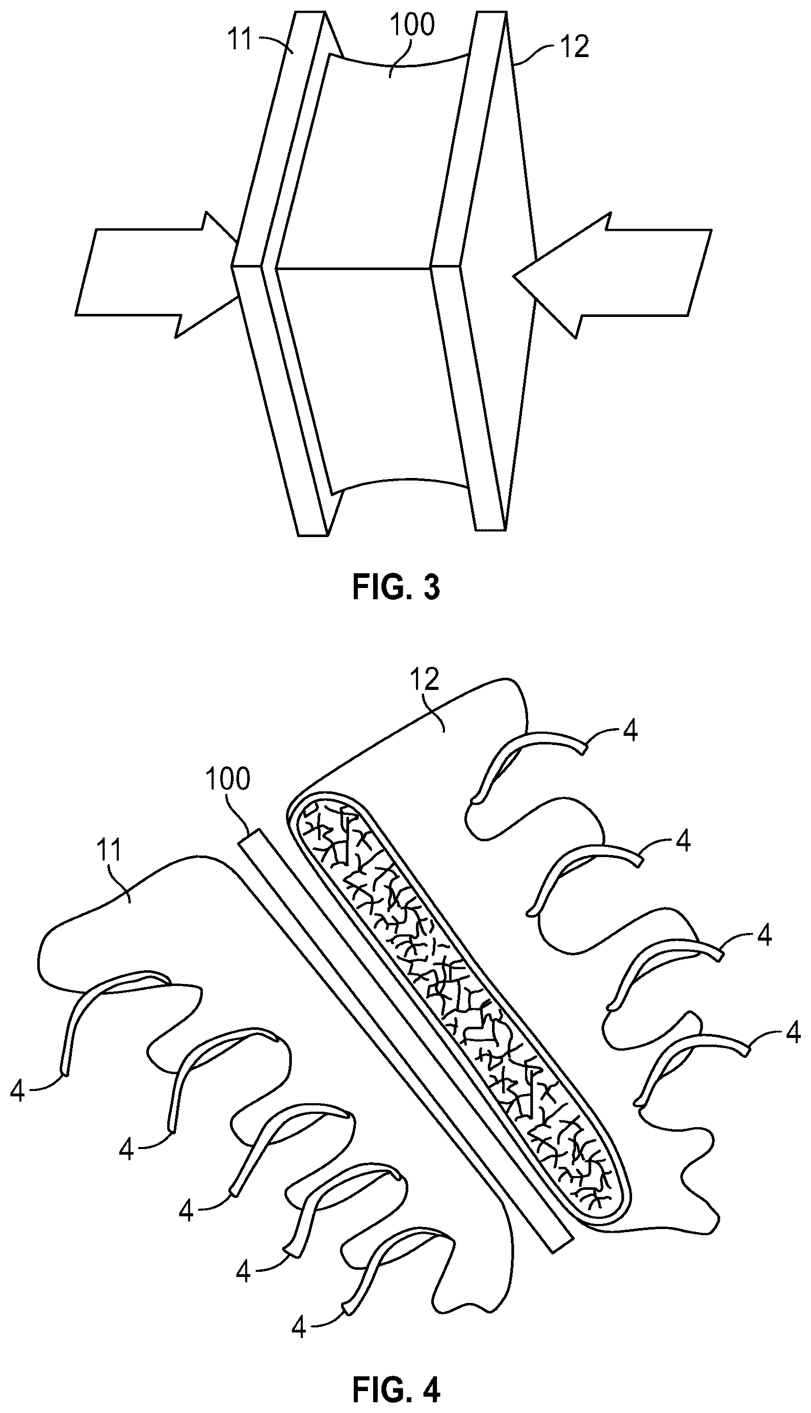 Patent US12588999 Figure 2 – System and method to fuse bone