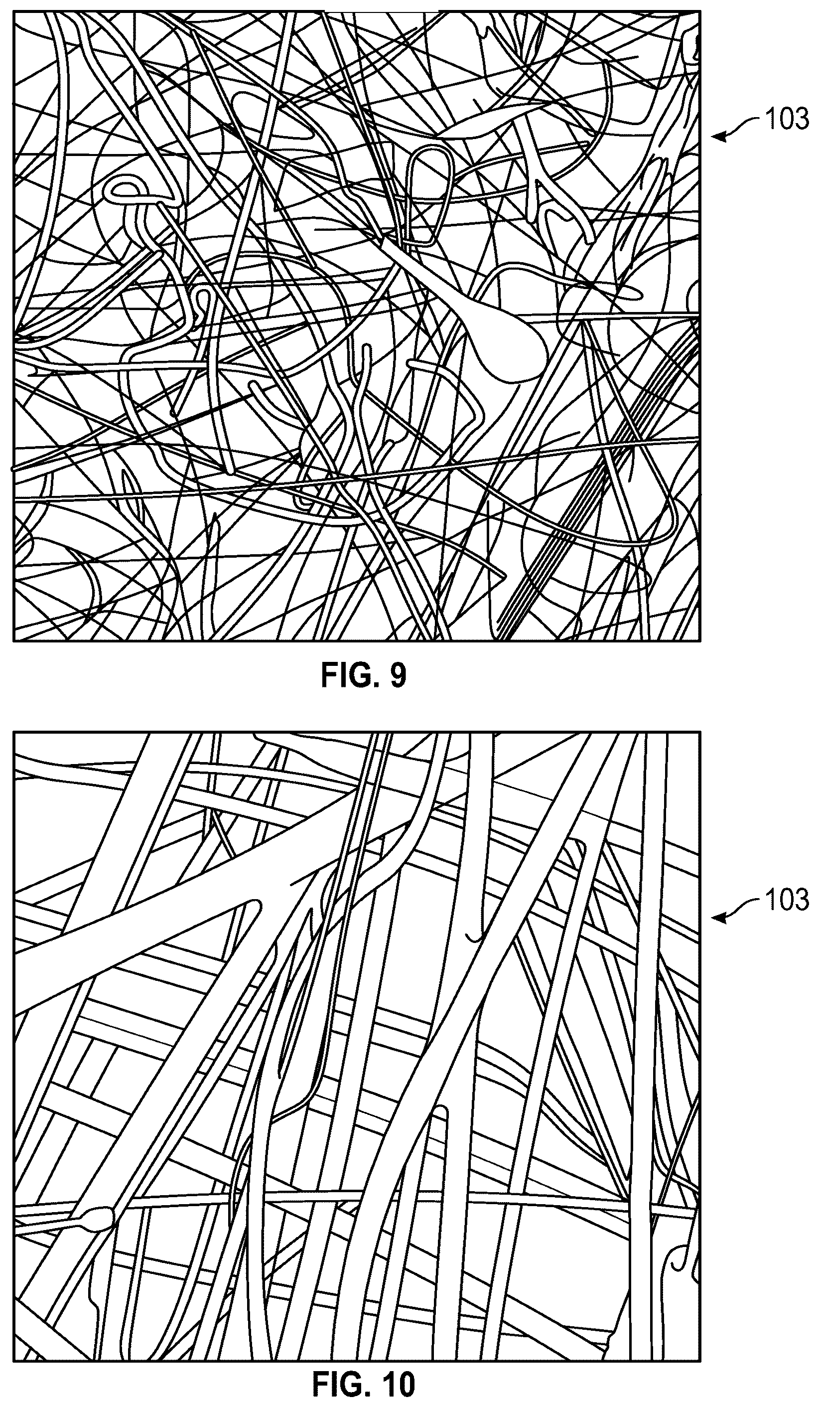 Patent US12588999 Figure 5 – System and method to fuse bone