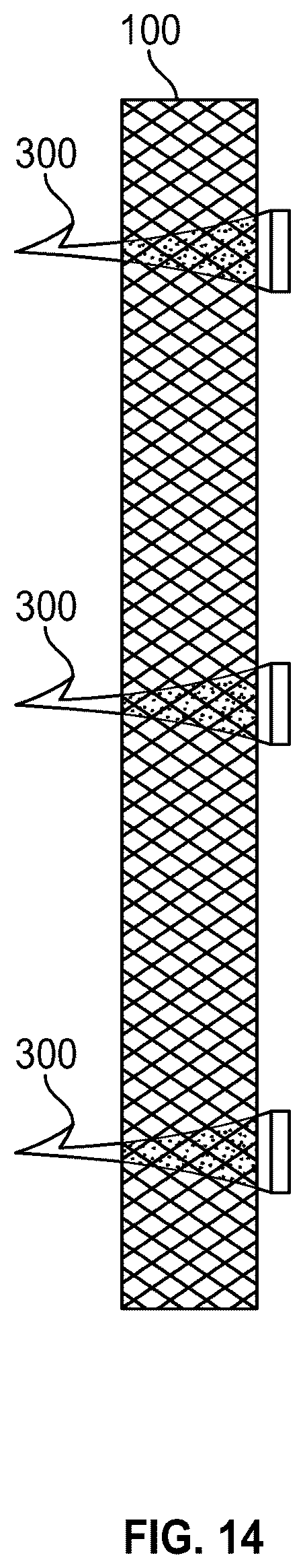 Patent US12588999 Figure 9 – System and method to fuse bone