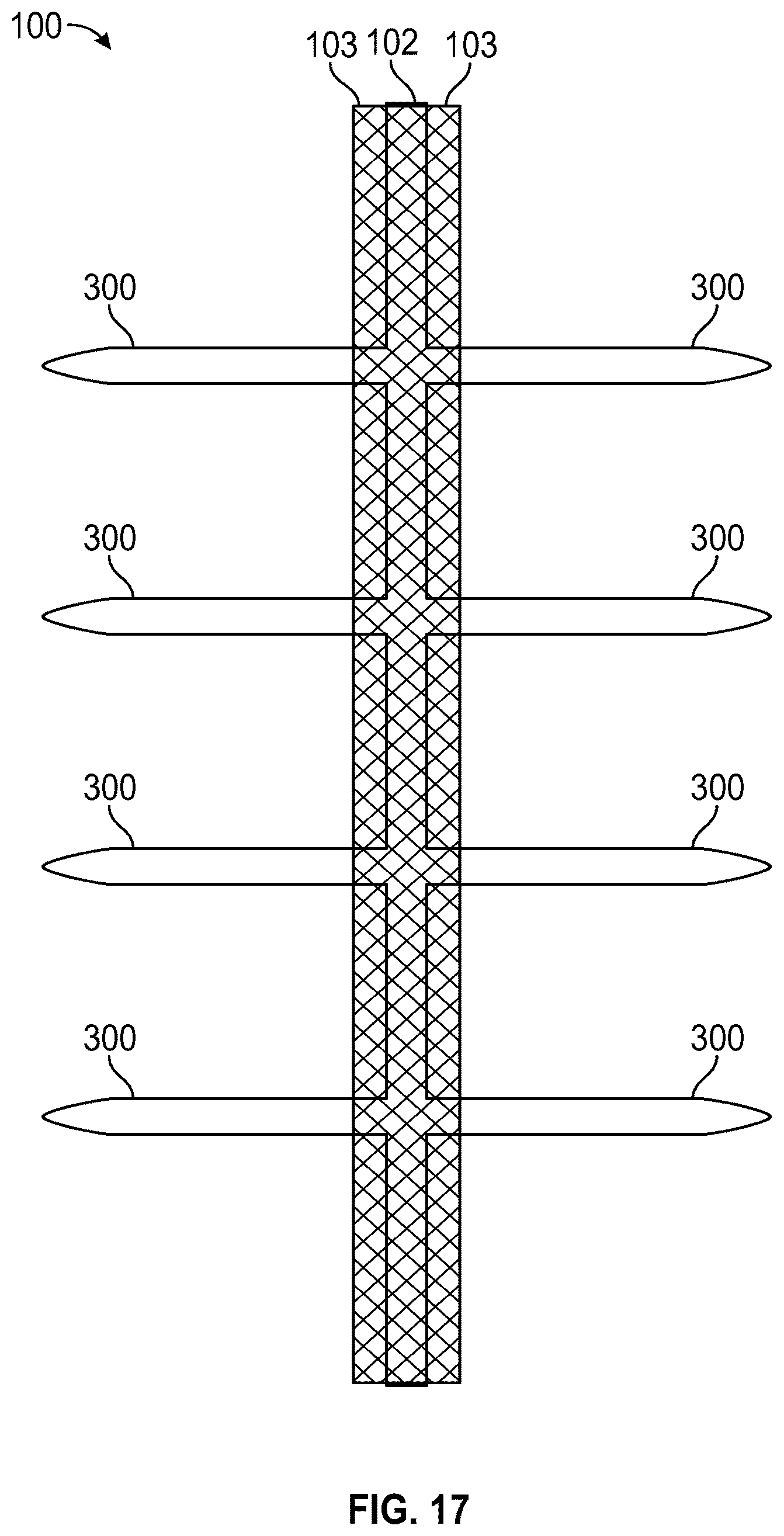 Patent US12588999 Figure 11 – System and method to fuse bone