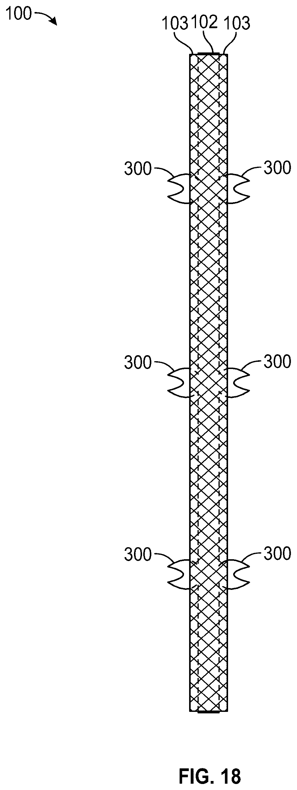 Patent US12588999 Figure 12 – System and method to fuse bone